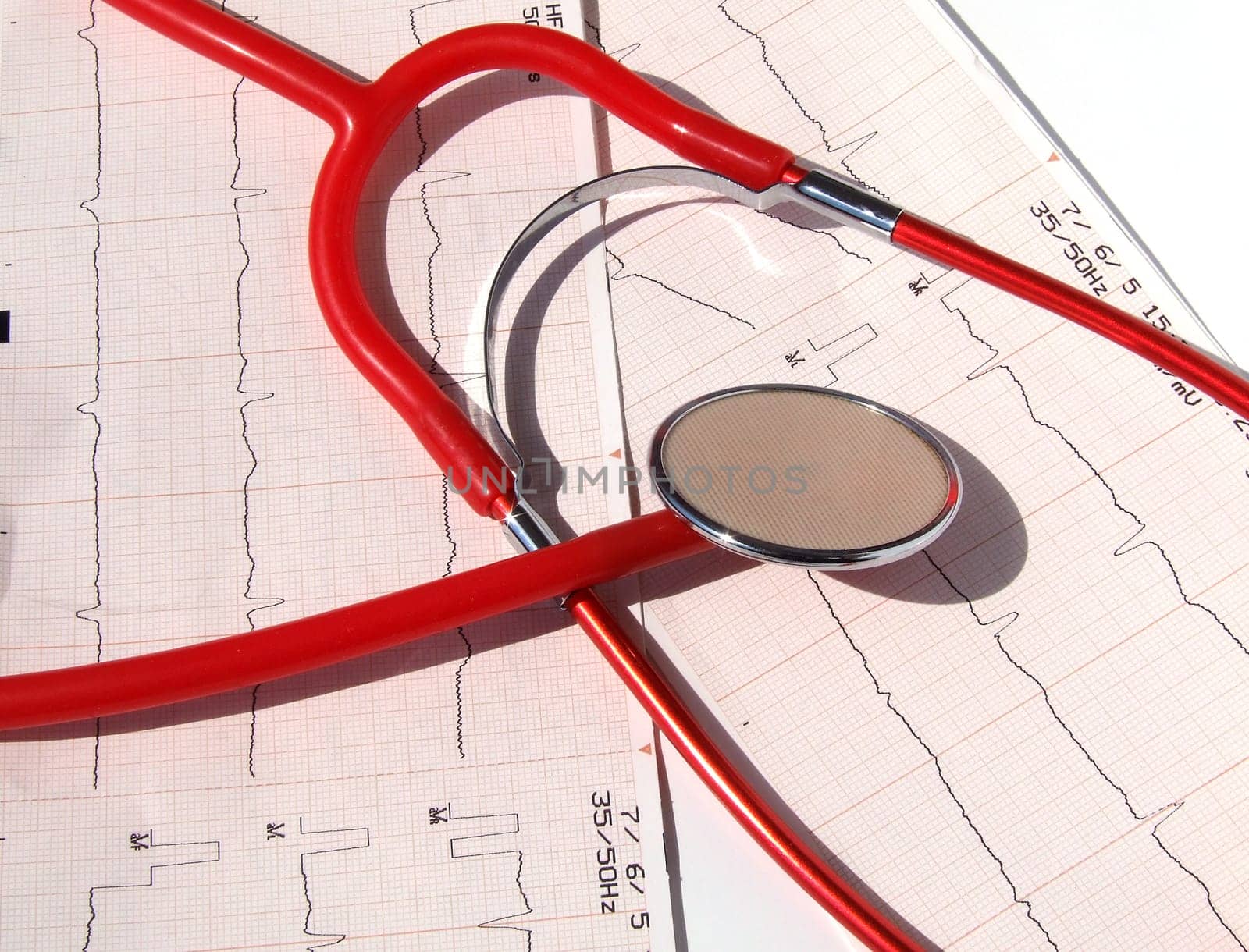 ELECTROCARDIOGRAM