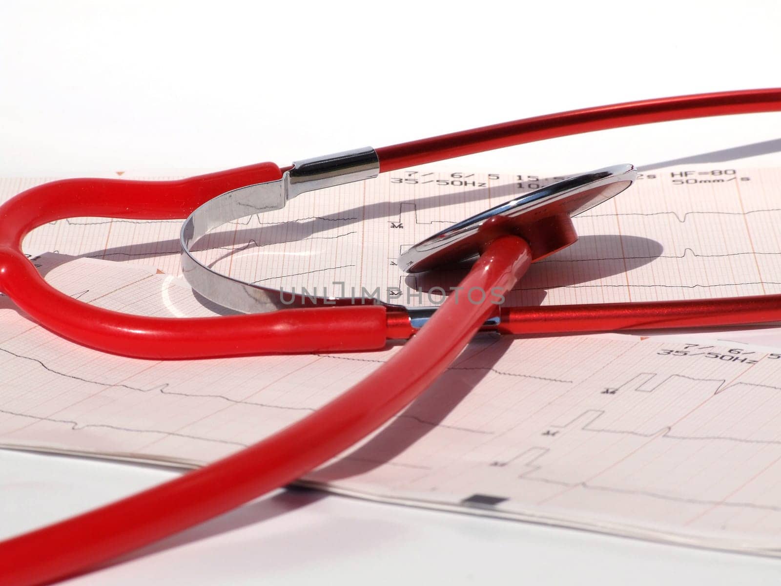 ELECTROCARDIOGRAM