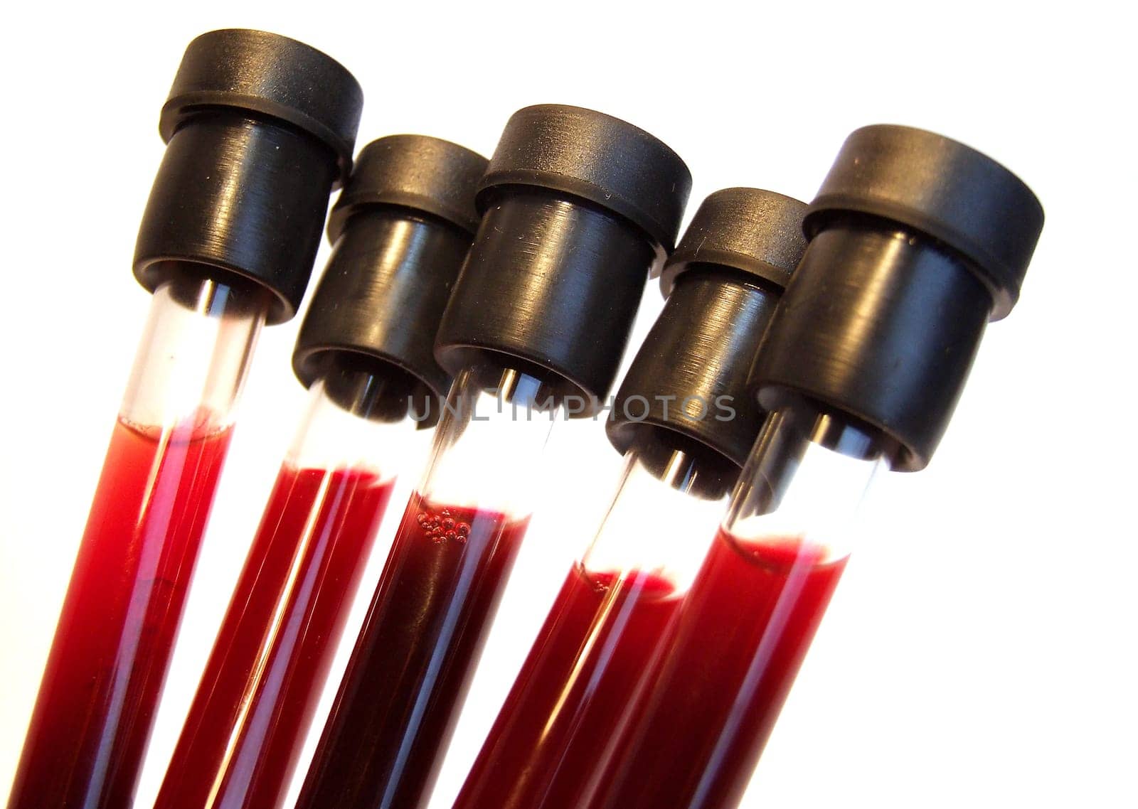 Blood samples