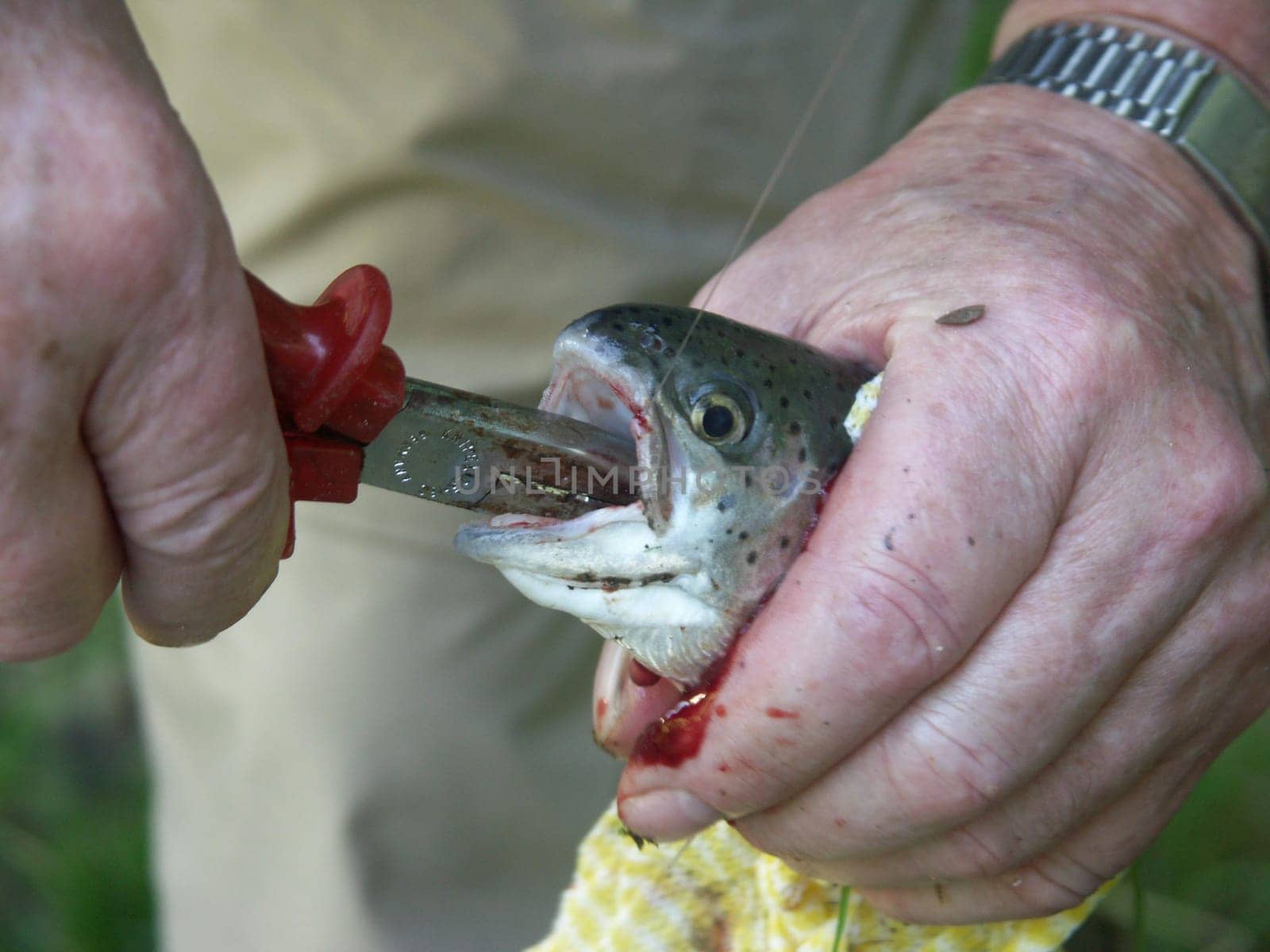 Removing the fish hook