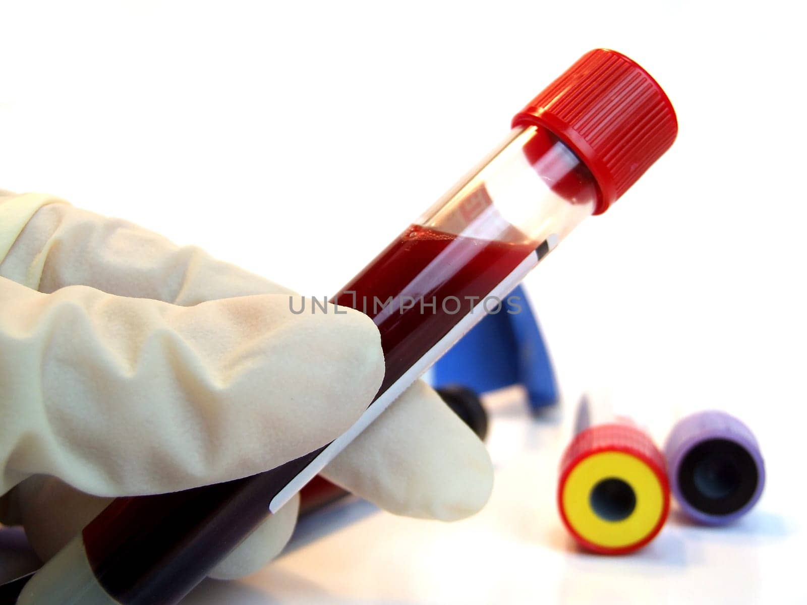 Blood test