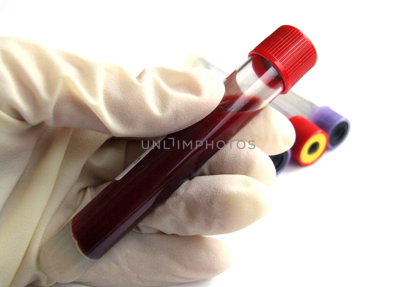 Blood test