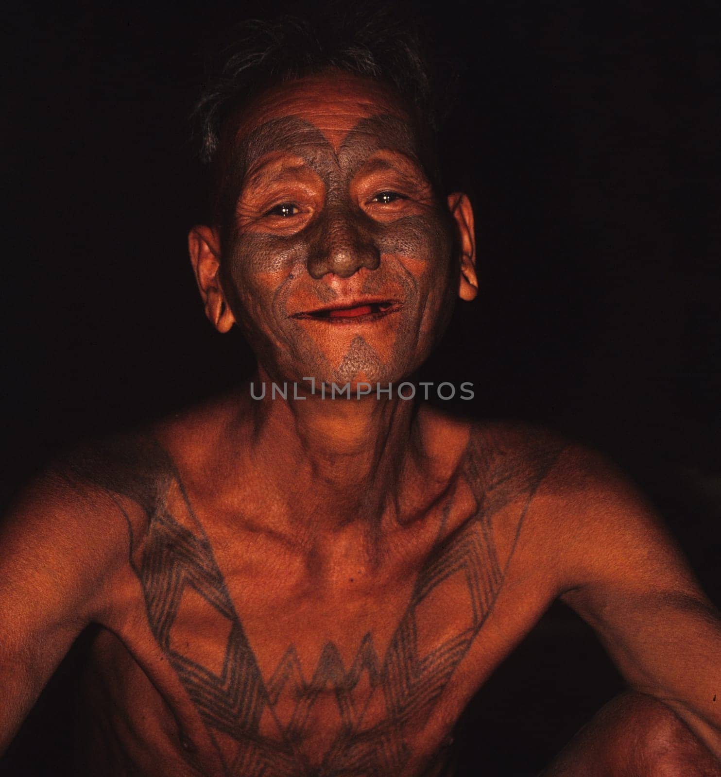 my "uncle"" Longshaw,member of the Konyakstames in the north of Nagaland (N/O-india). He still wears the traditional tattoo of the former headhunters. As a teenager,this T. was treated with bamboo sticks and a charcoal/fat mixture"