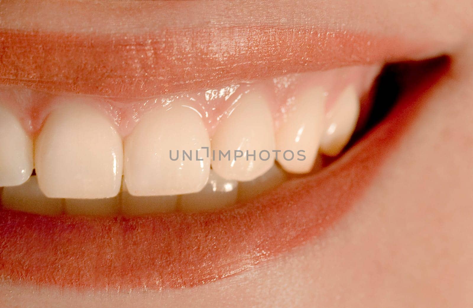 Teeth - Laughter