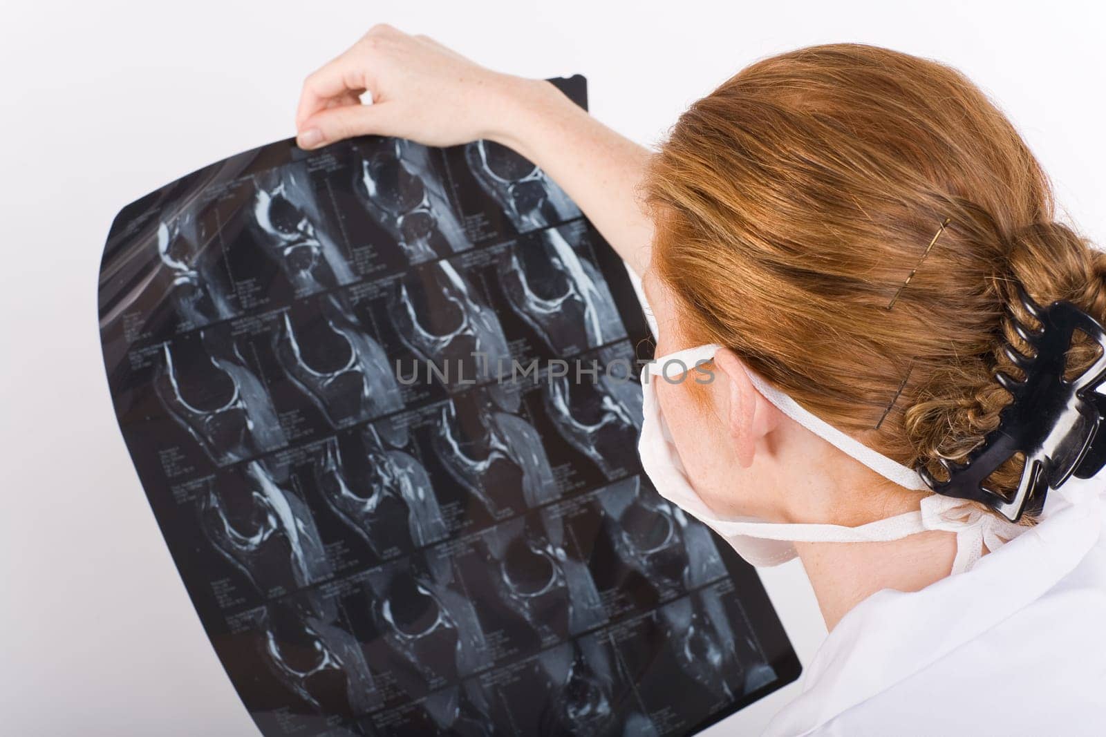 Examine the X-ray image