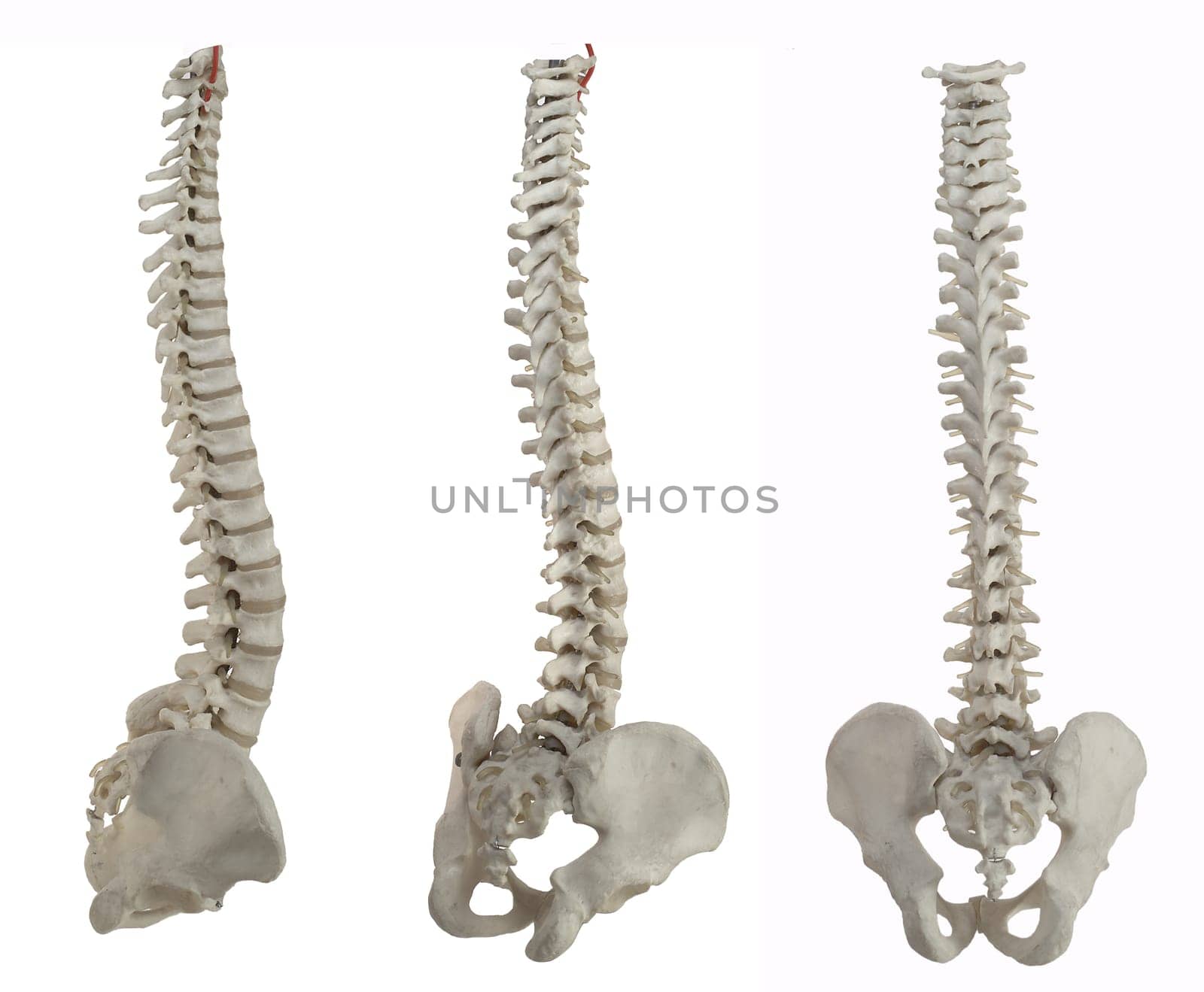 spines