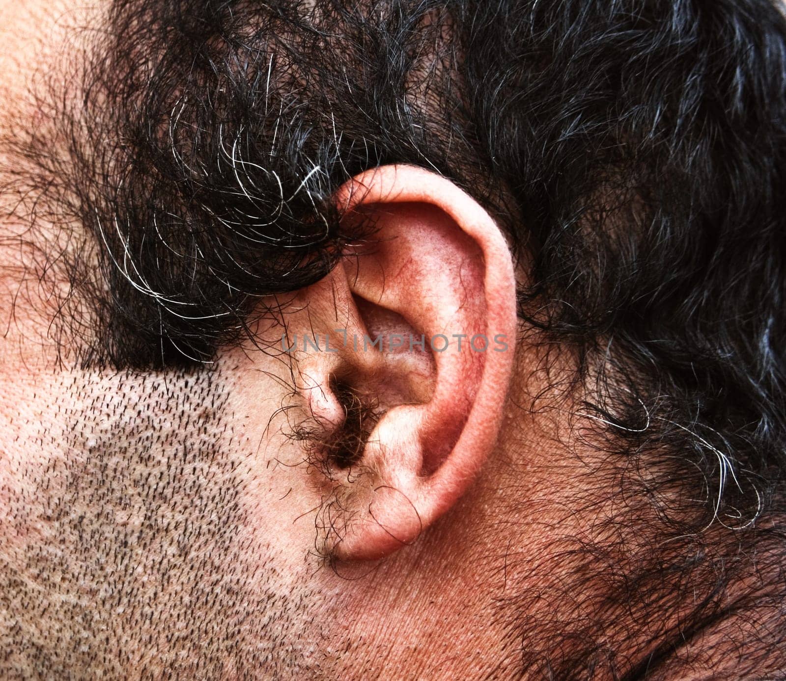 Hairy