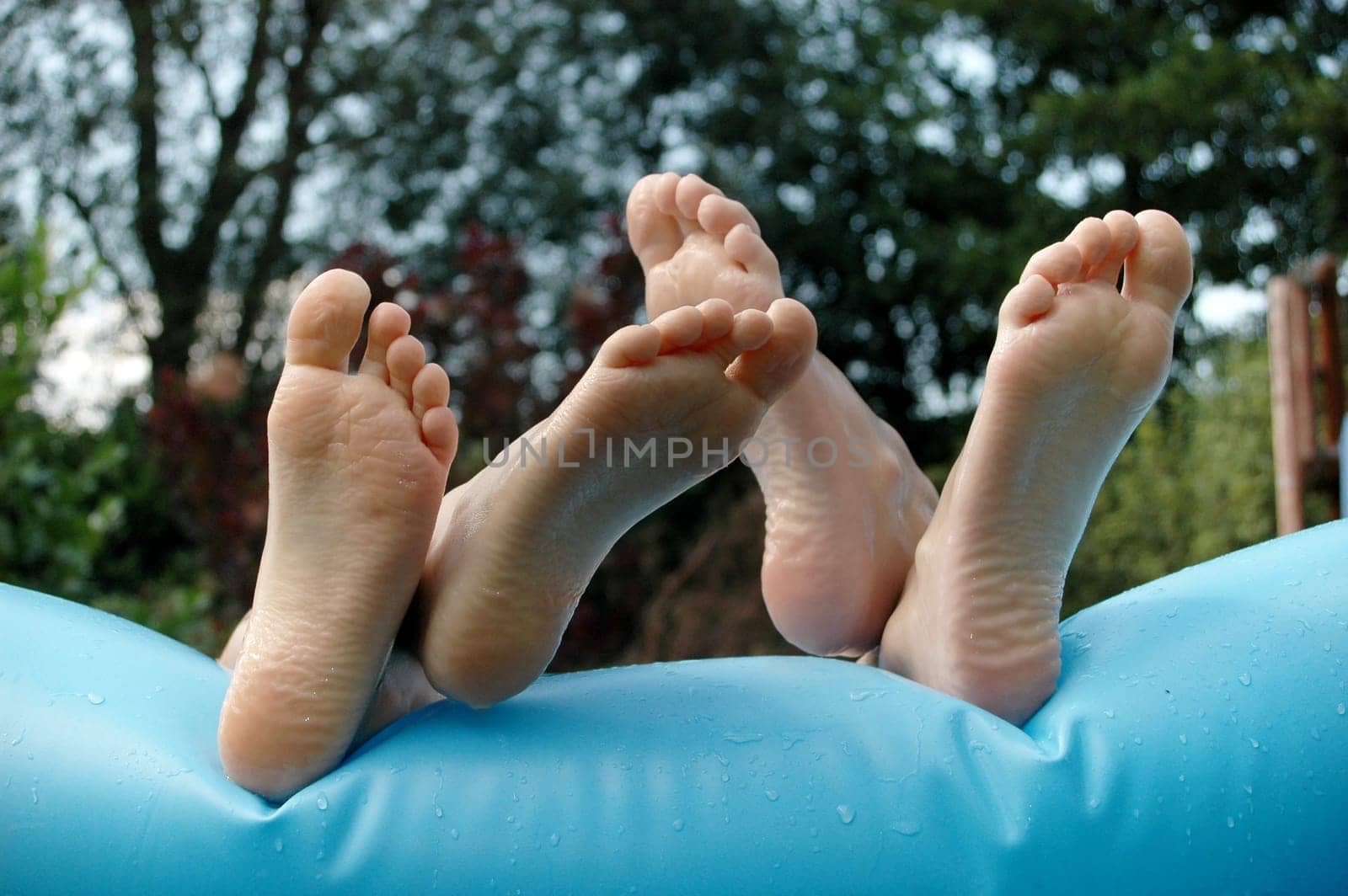 Shrivelled feet