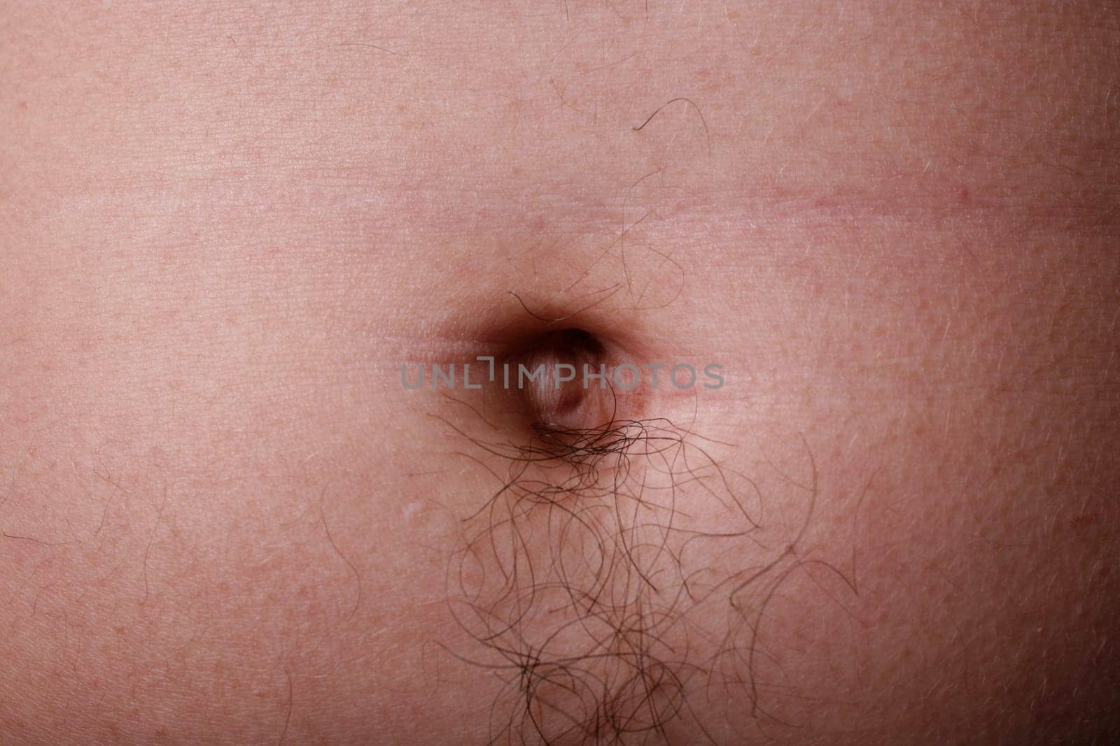 Navel