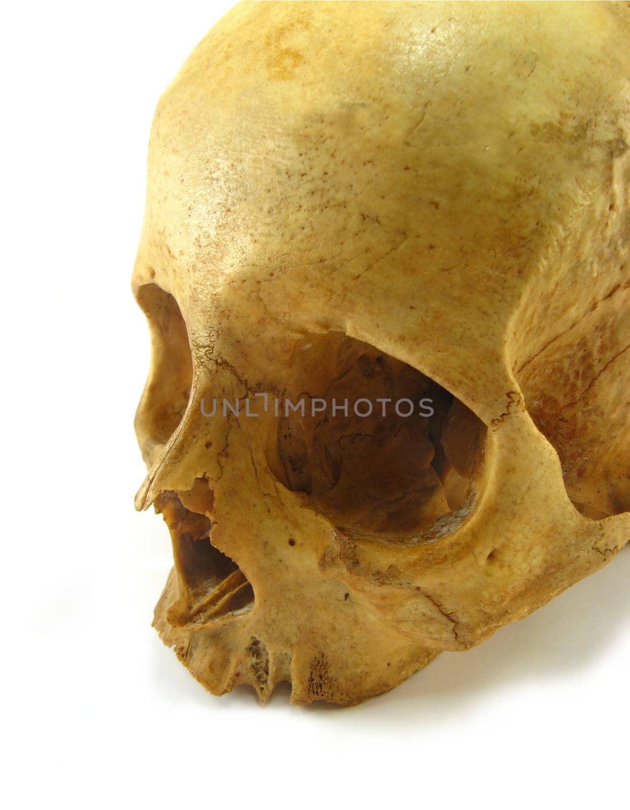 skull