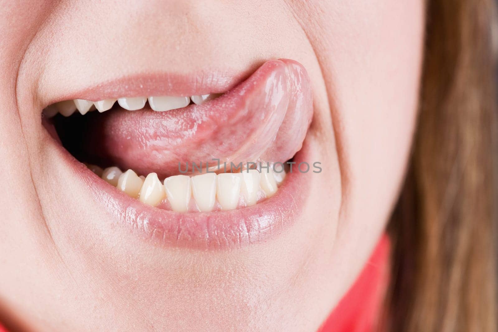 Dental hygiene