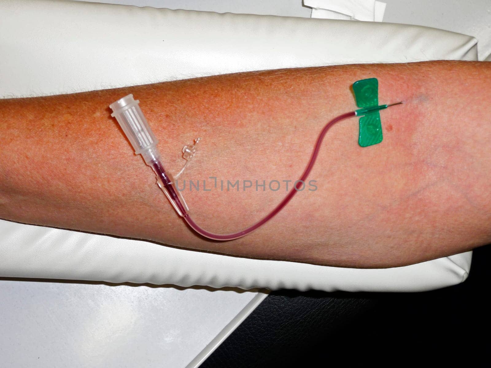 Blood draw