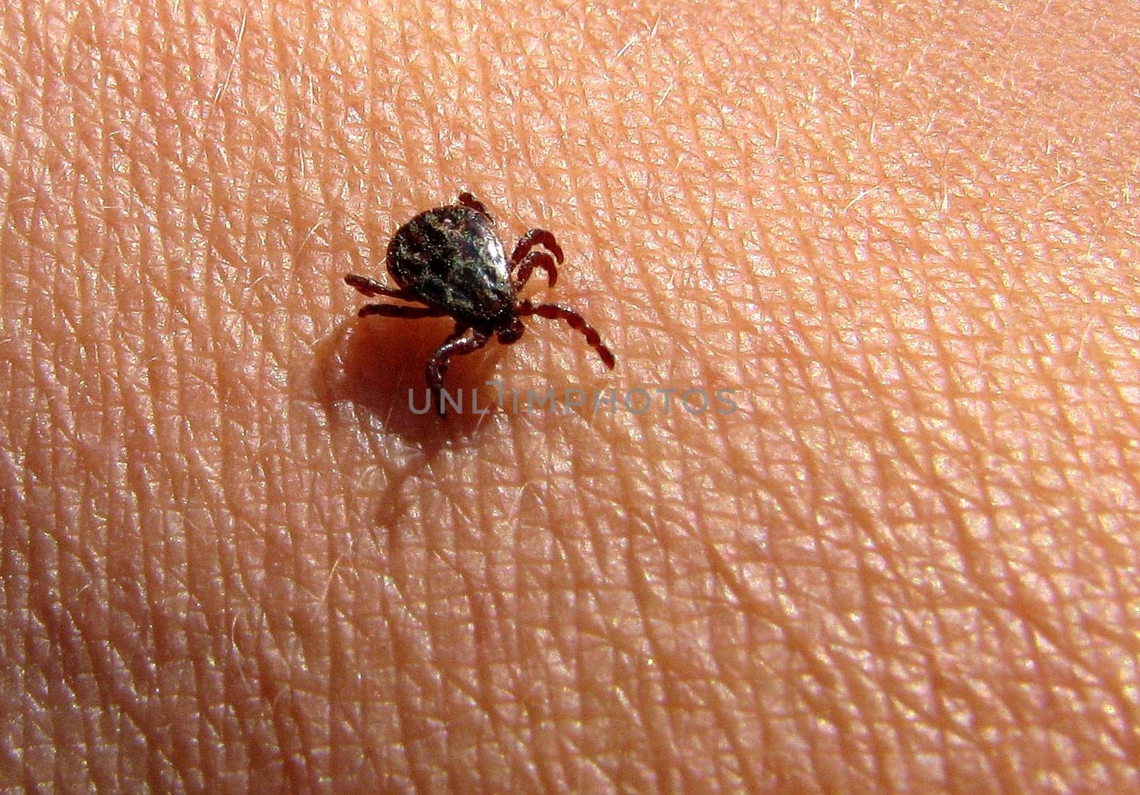 Tick on the skin