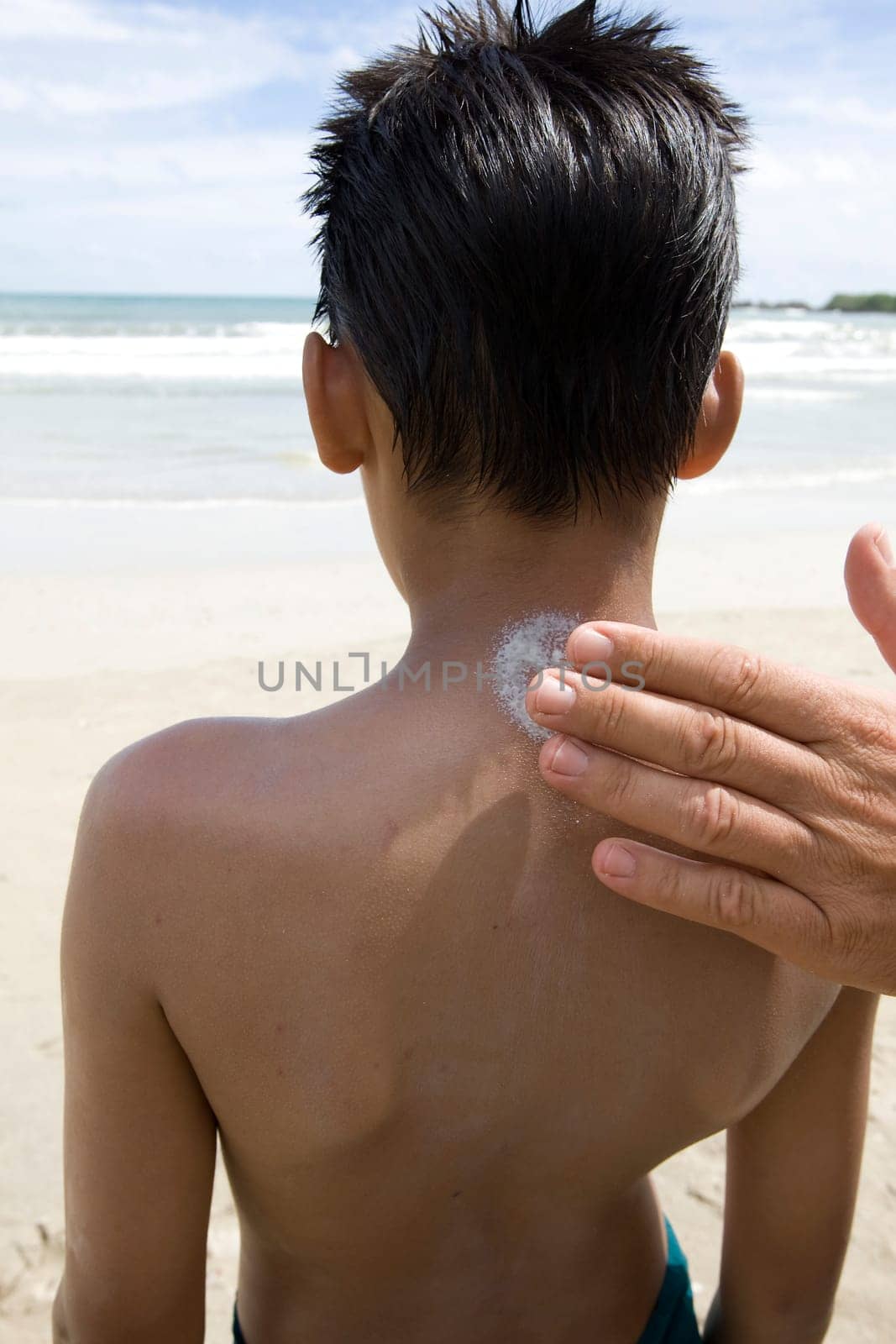 Sunscreen lowers risk of skin cancer