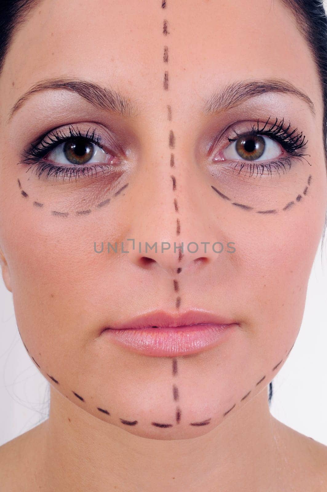 Woman before cosmetic surgery