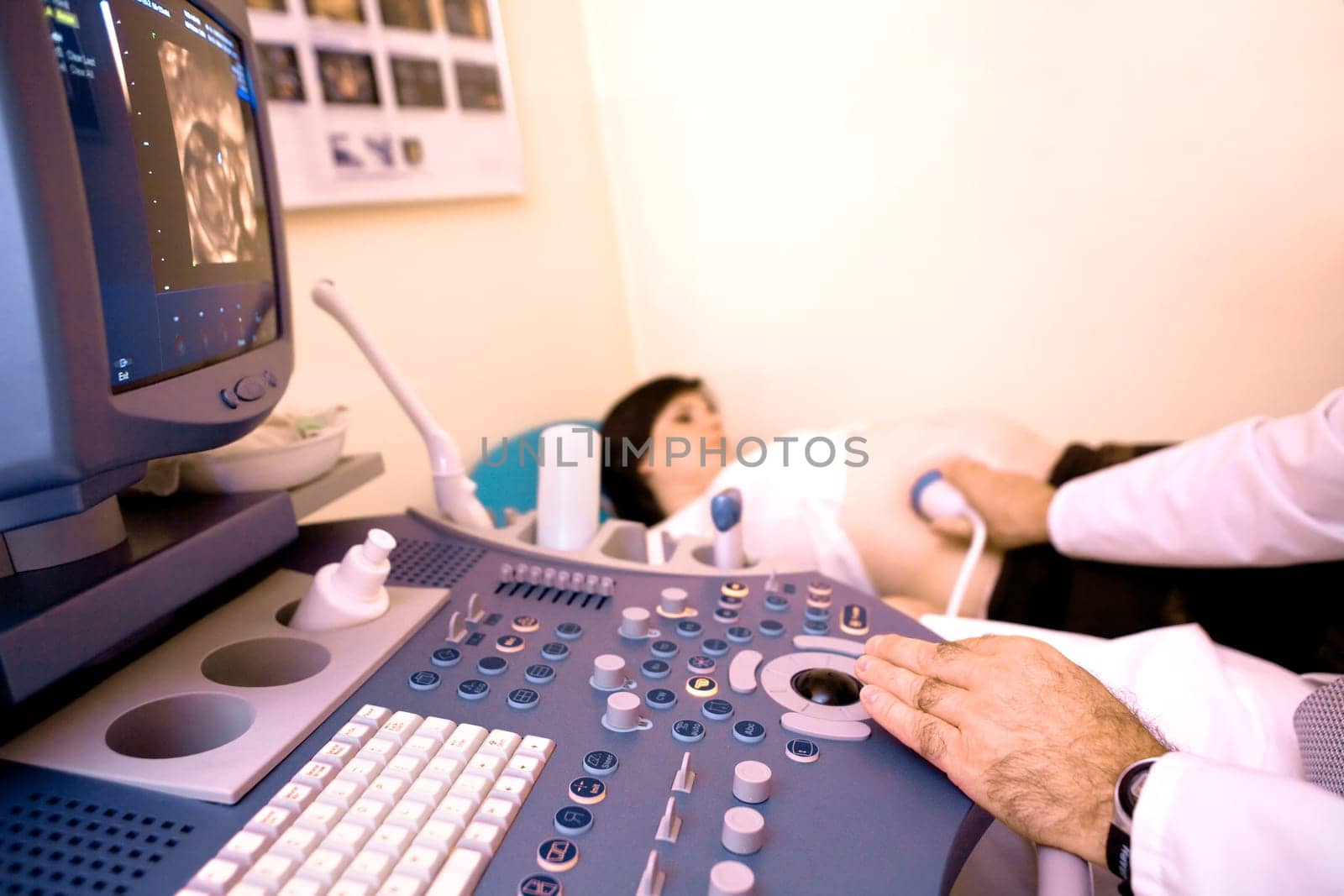 4D ultrasonic scan