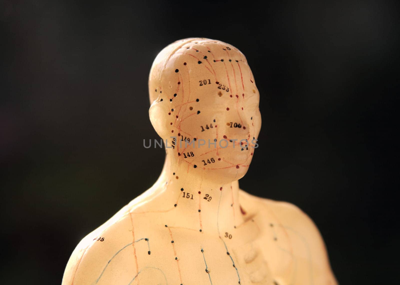 acupuncture figure