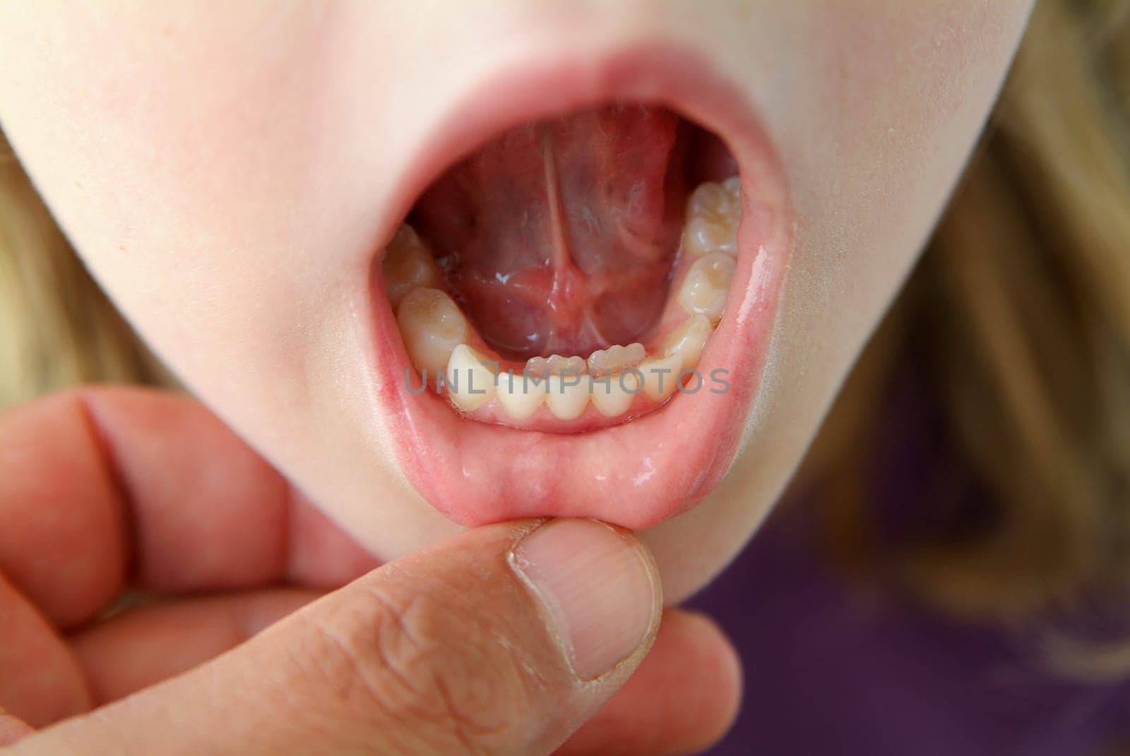 Teeth