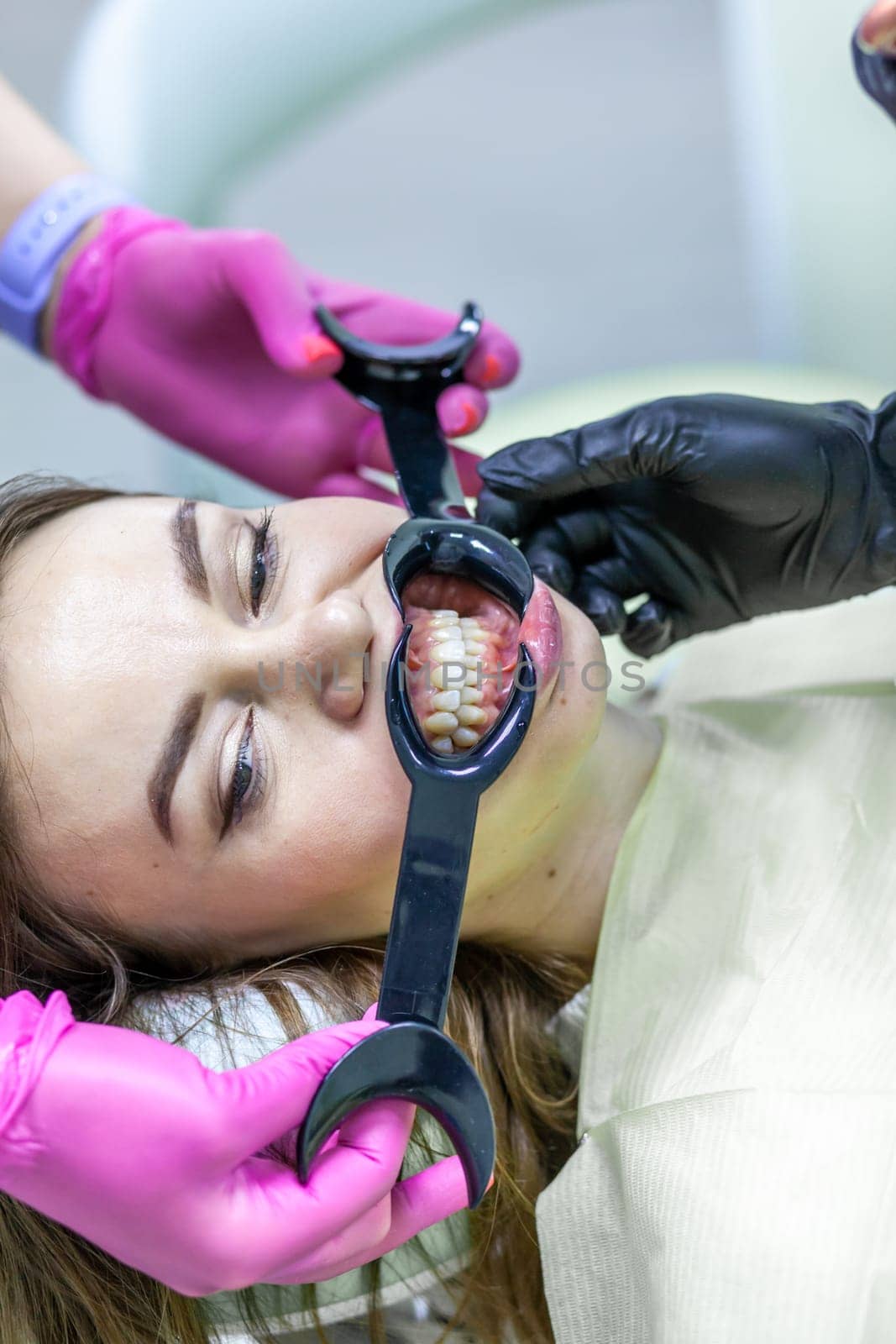 Beautiful woman with a mouth expander in a dental chair during by AnatoliiFoto