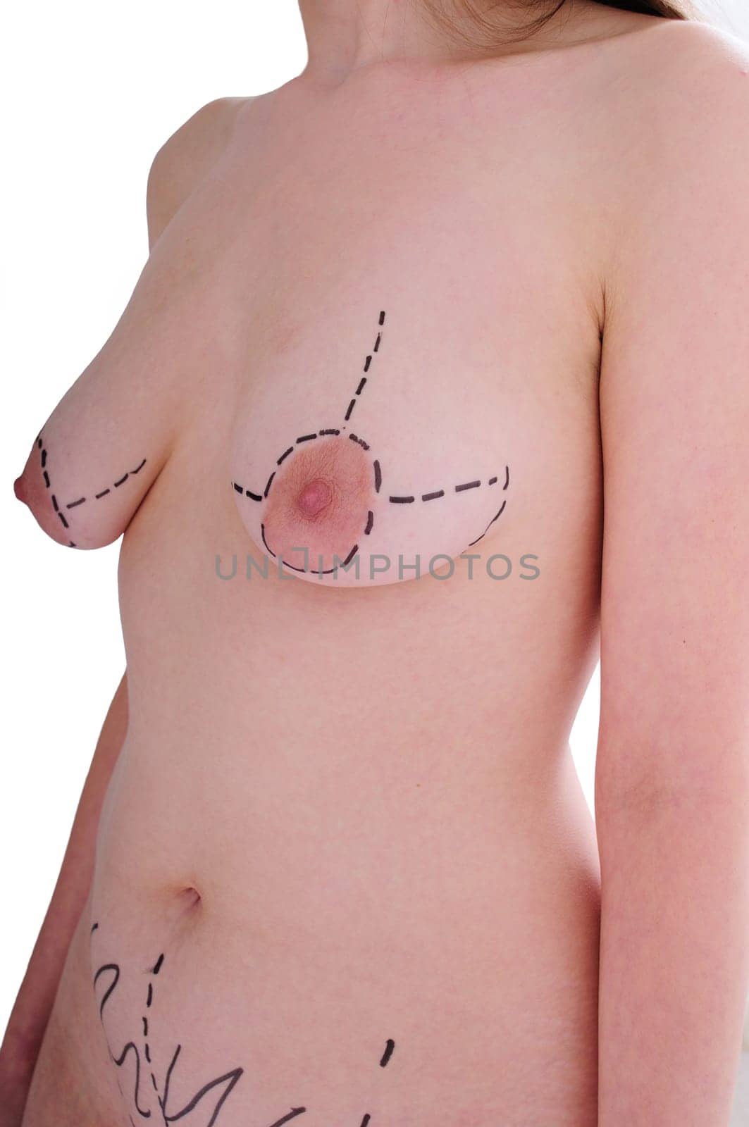 female breast before plastic surgery