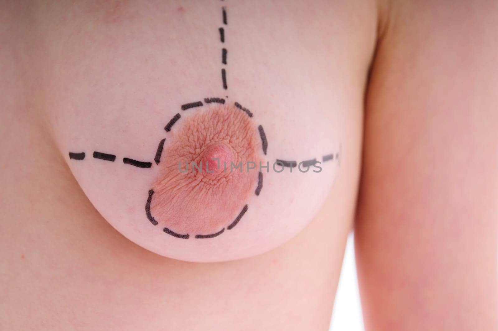 female breast before plastic surgery