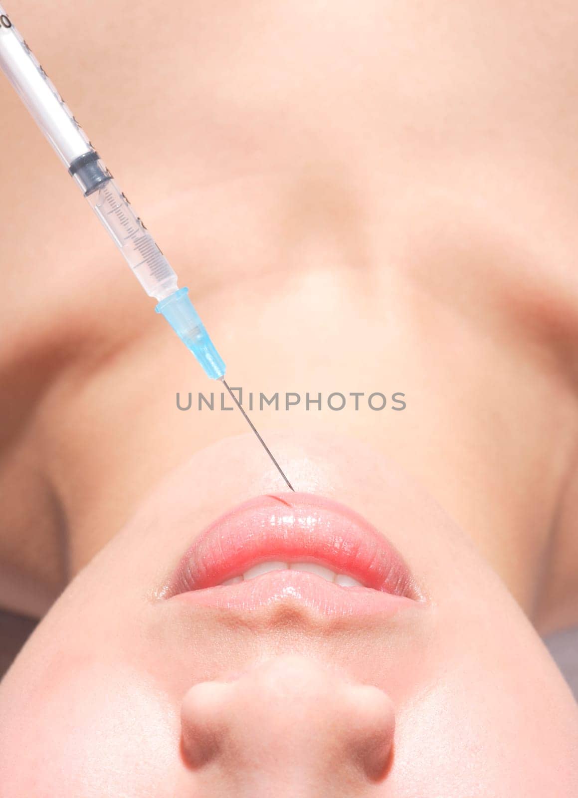 Woman gets collagen injections