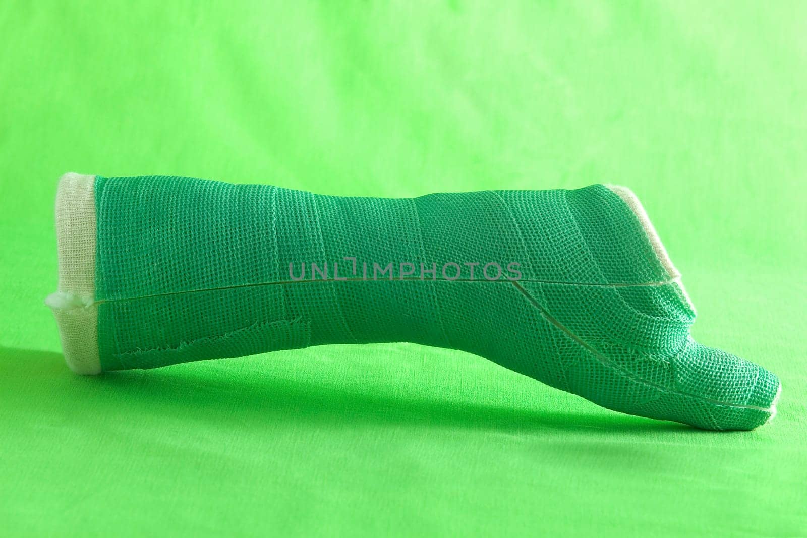 A removed cast