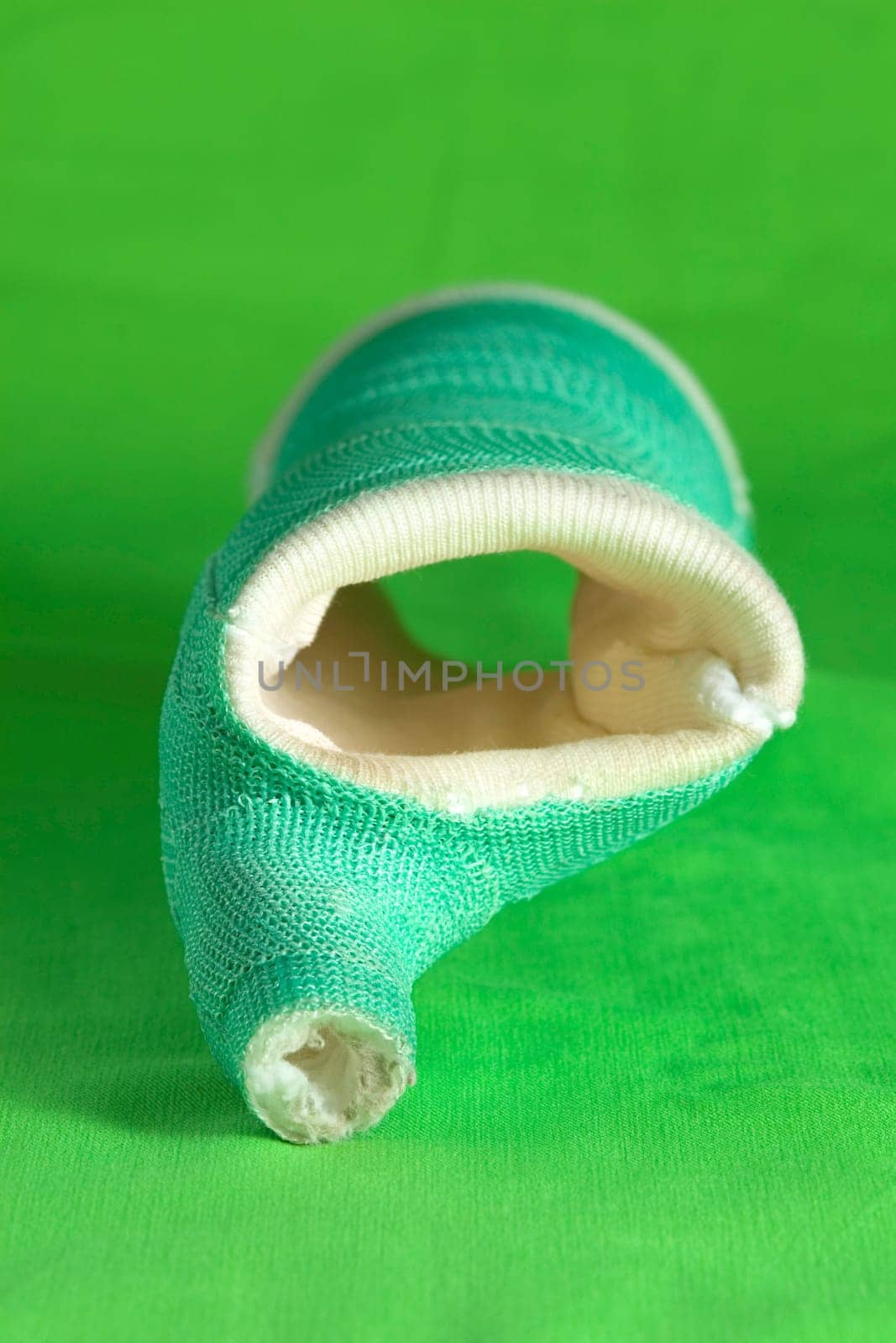 A removed cast