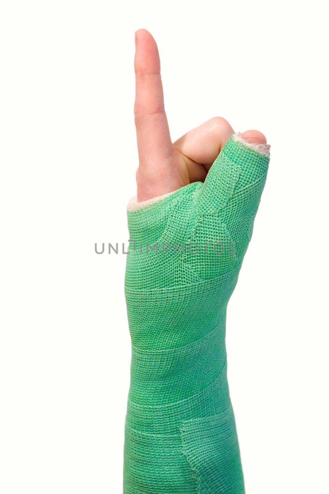 Arm in a cast