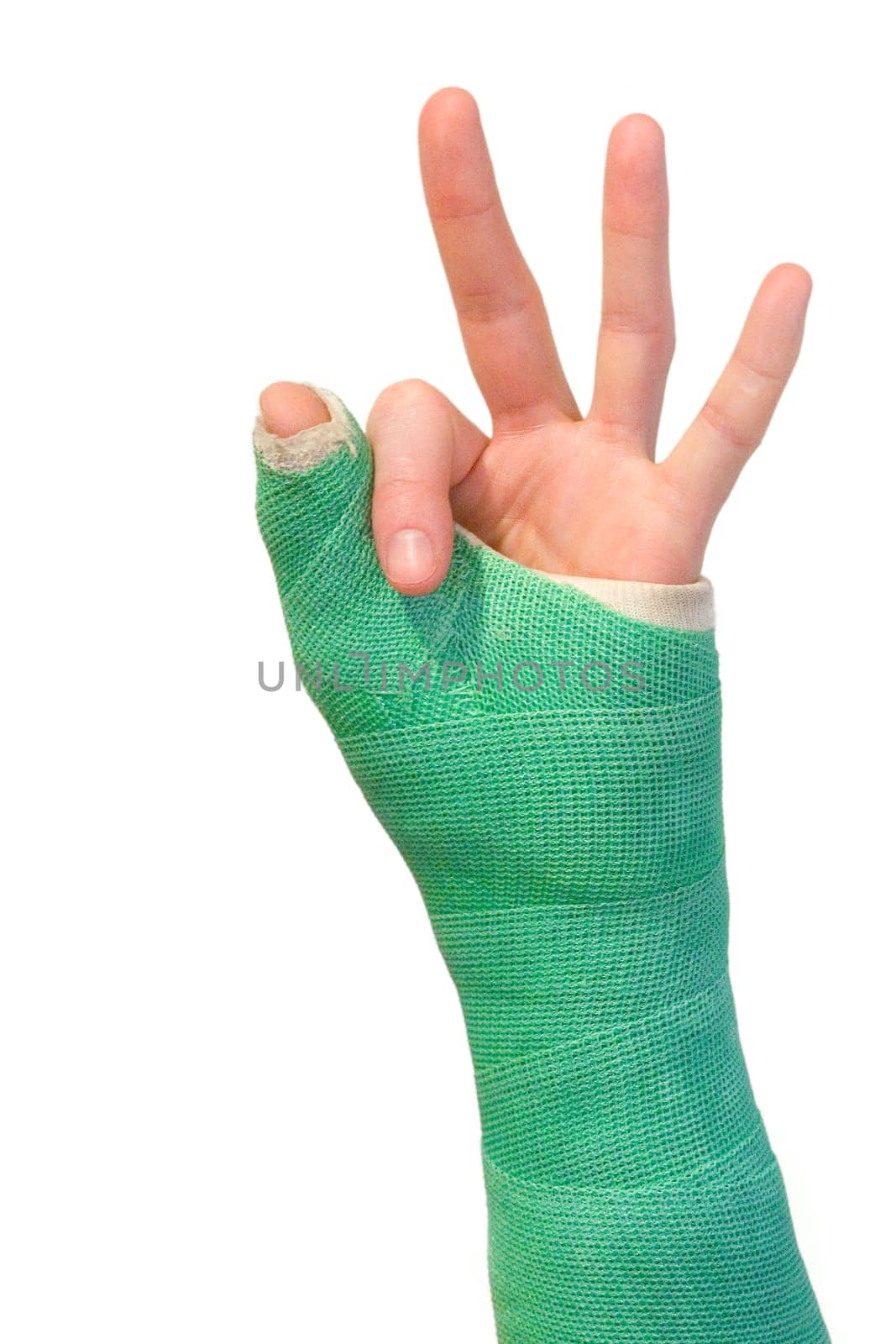 Arm in a cast