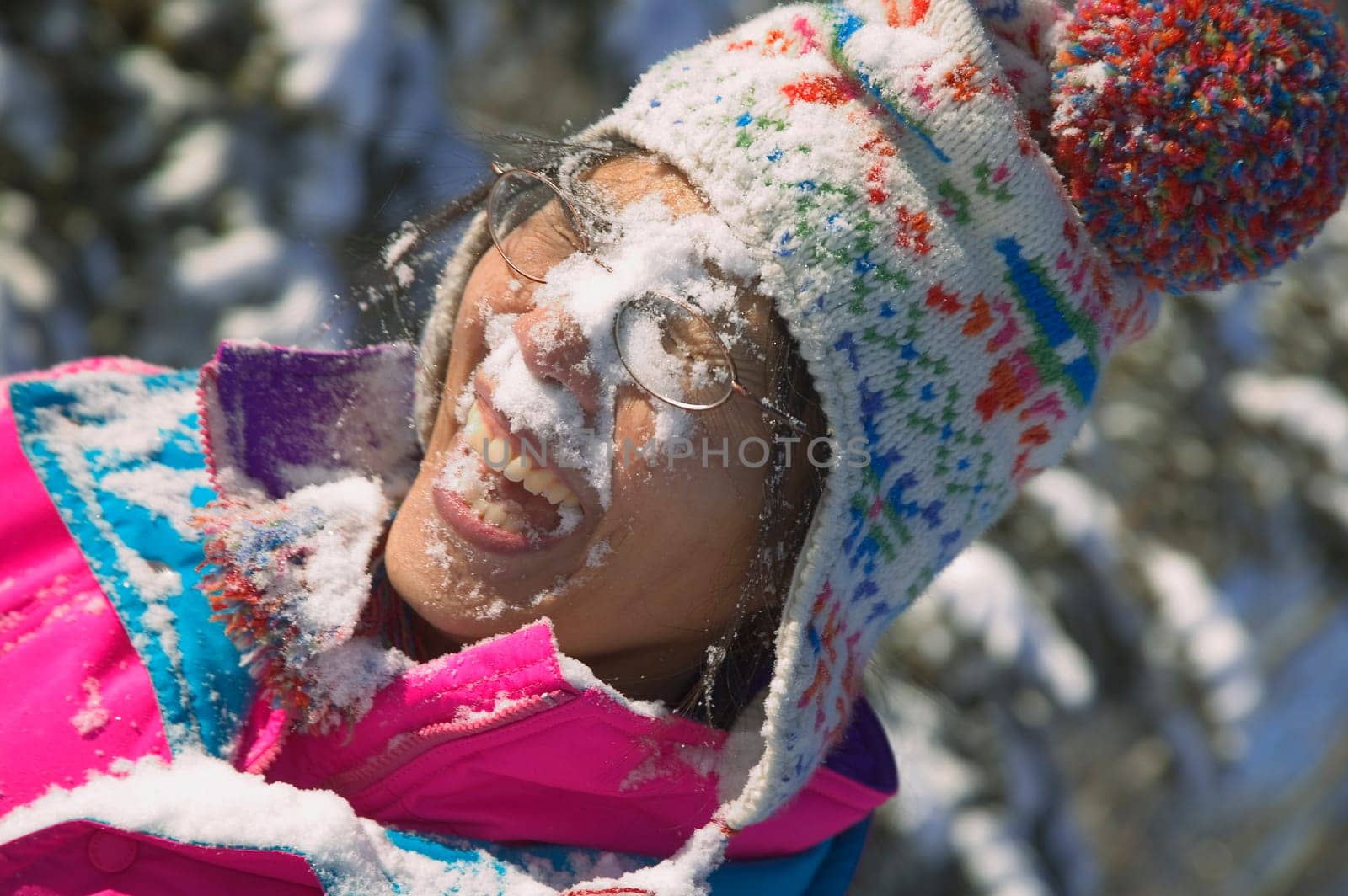 Snow in the face