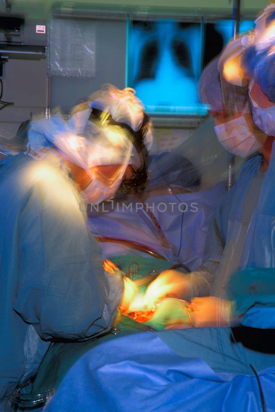 Surgeons Operating on Patient