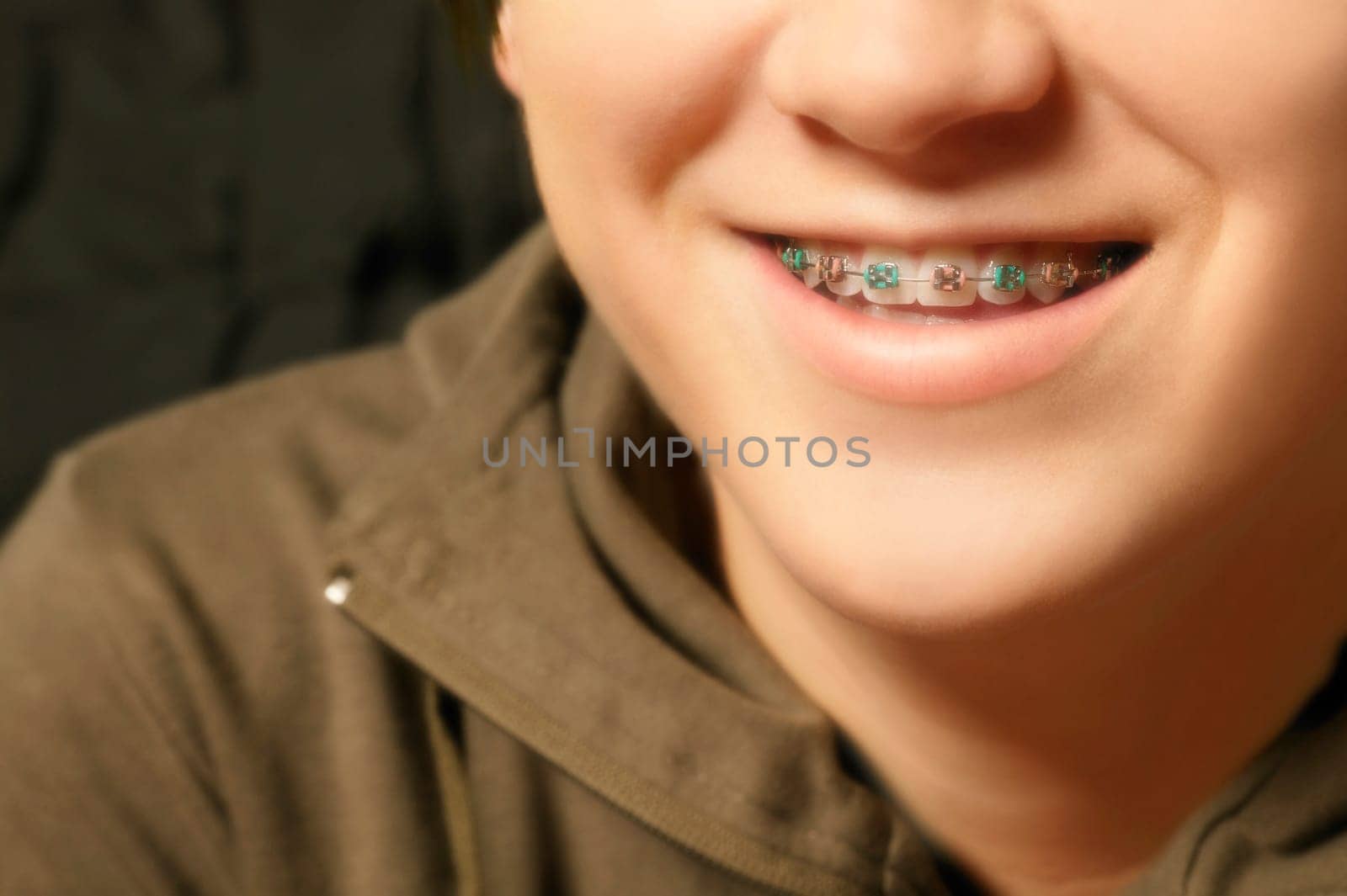 Child with braces