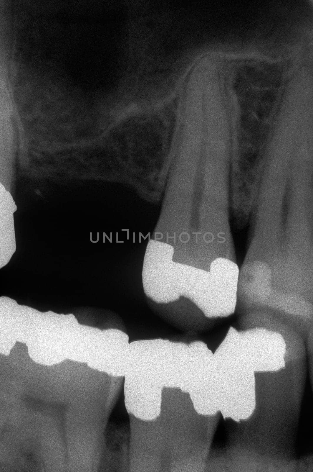 Dental x-ray