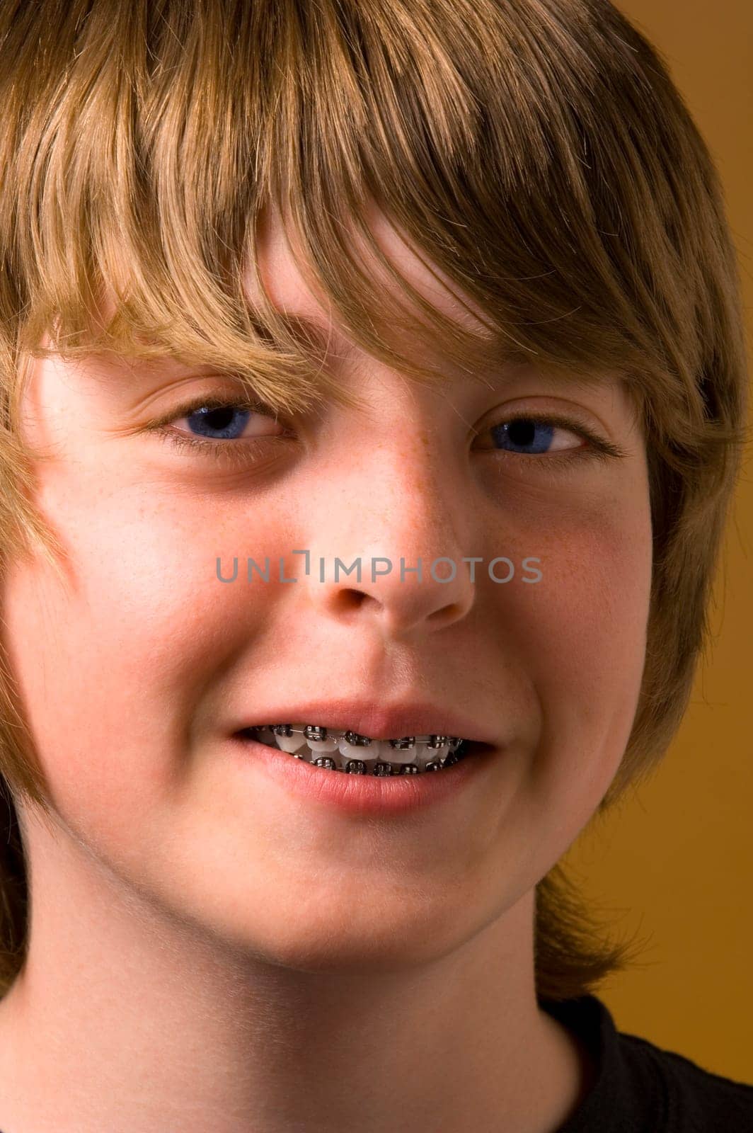 Boy with braces on his teeth