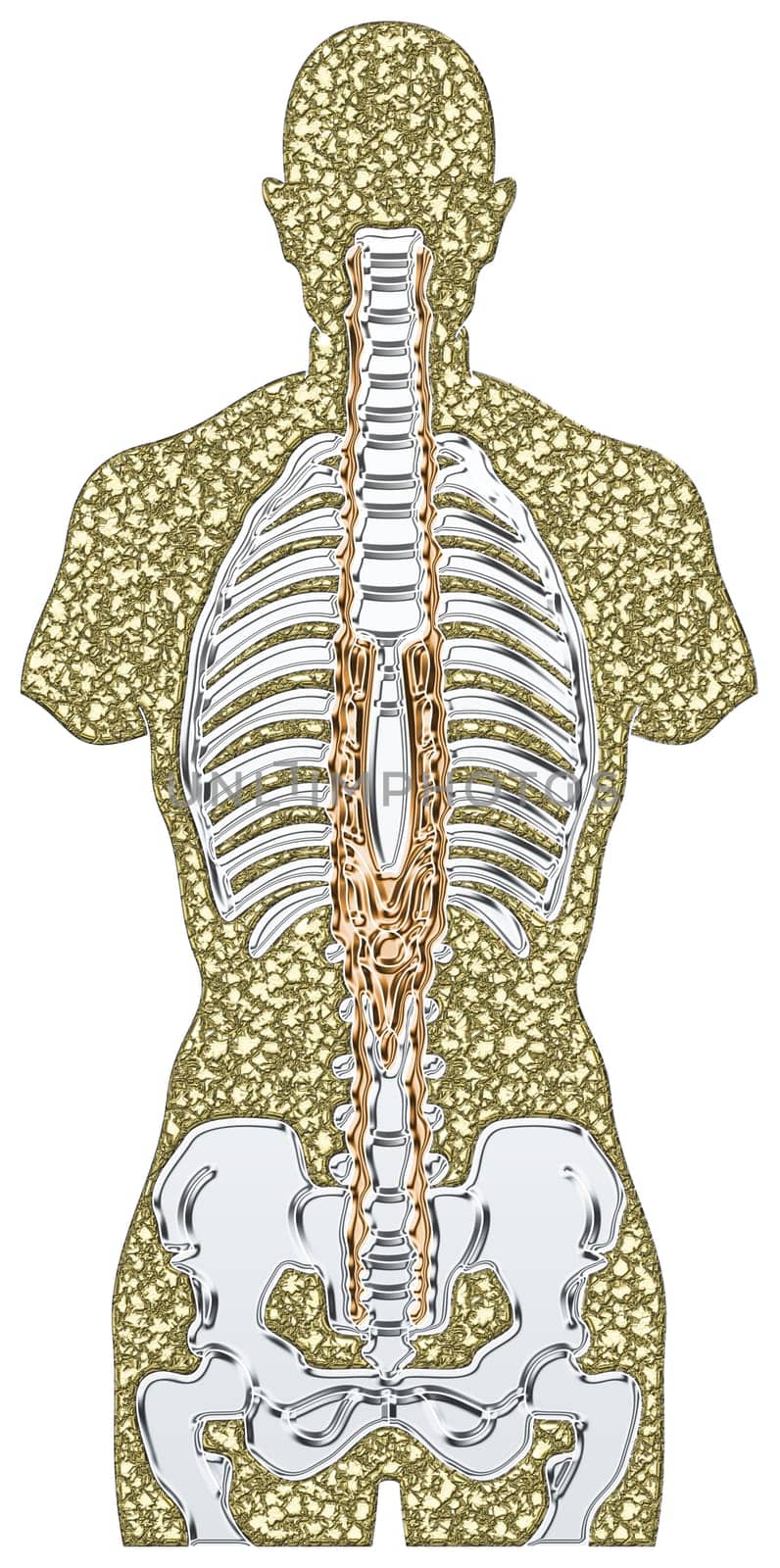 Skeleton - Metal