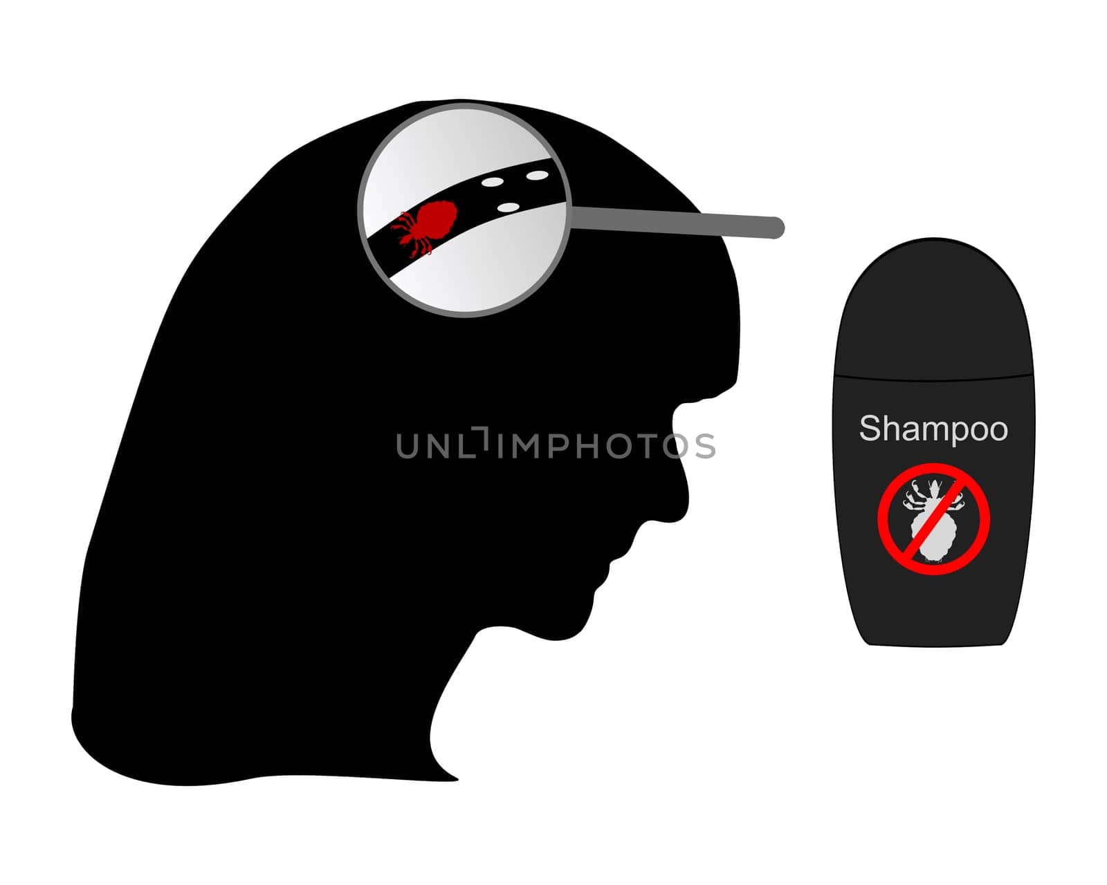 Woman's head,louse,nits and lice shampoo