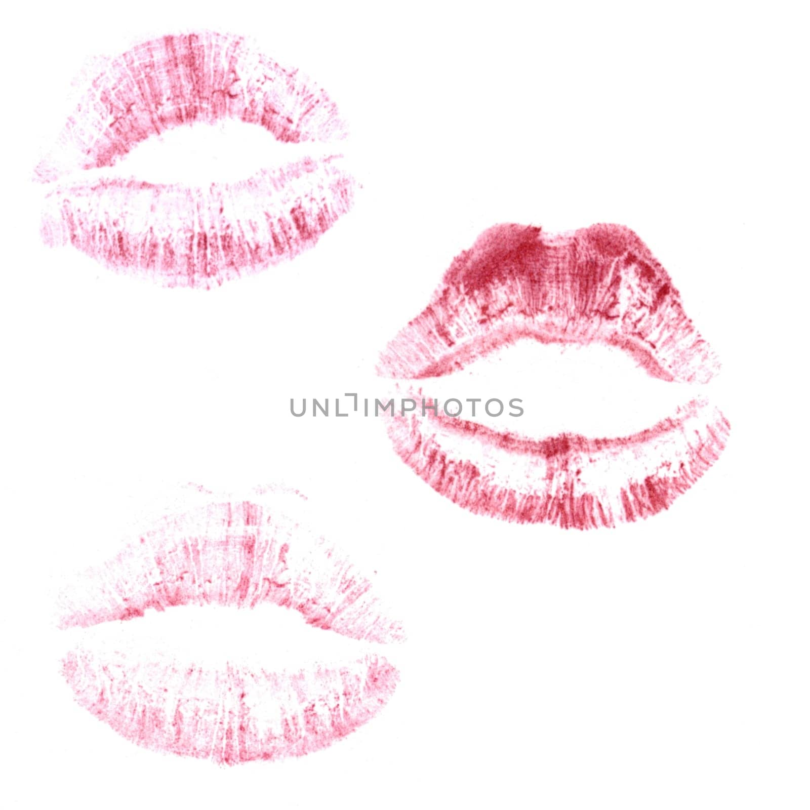 Kisses
