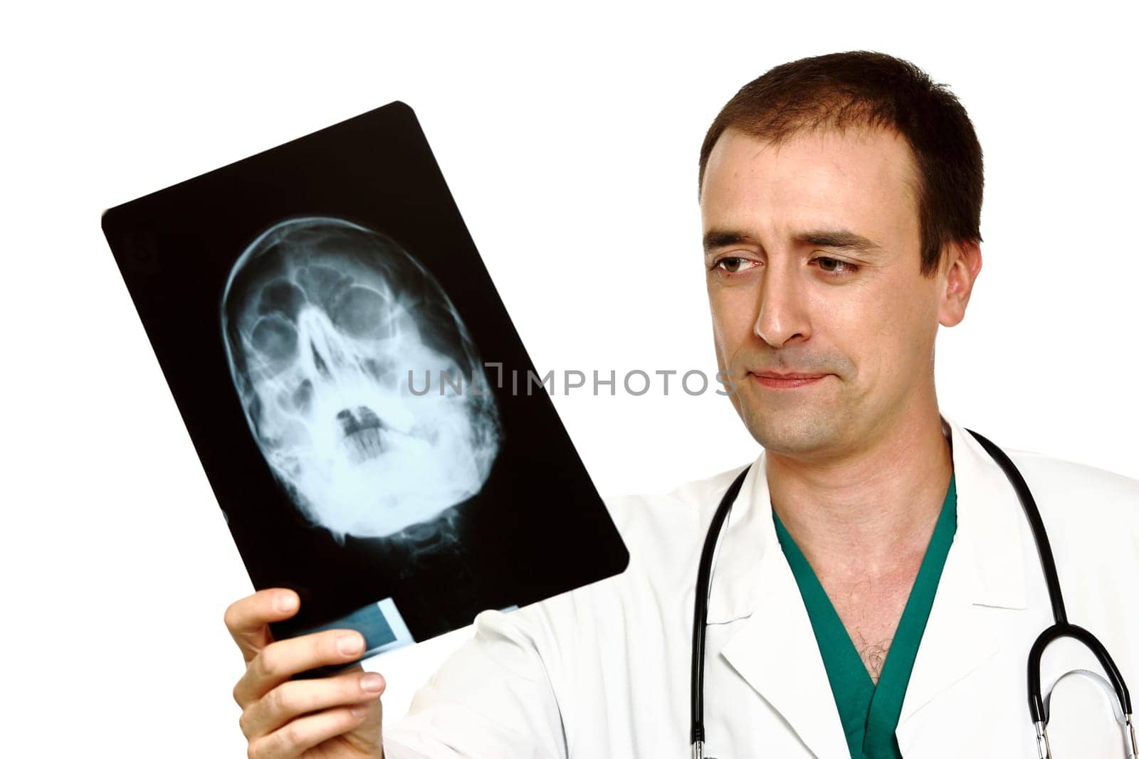young caucasian doctor and x-ray of head isolated on white