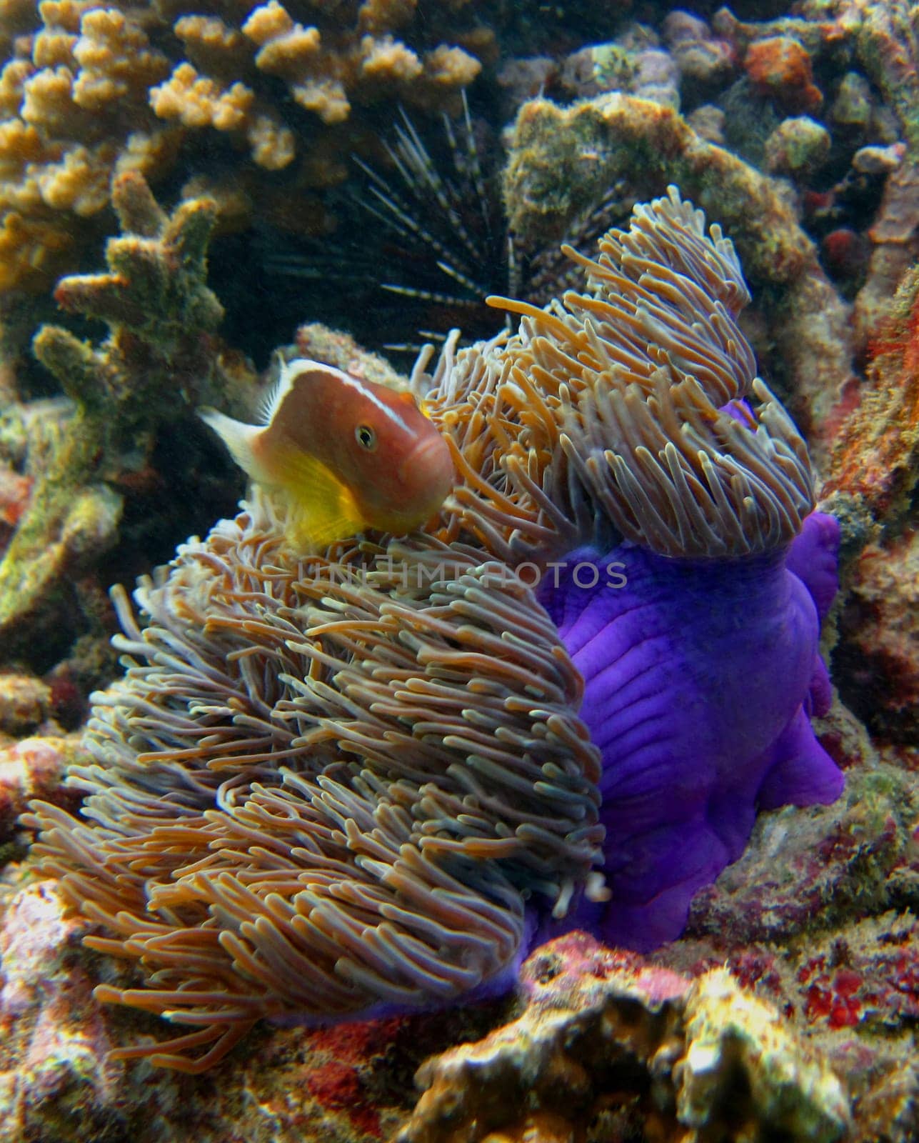 Anemone