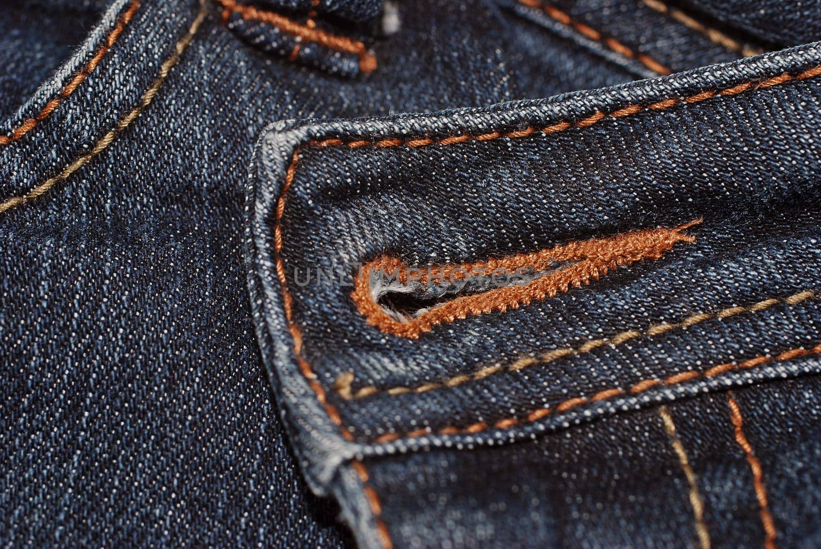 Buttonhole