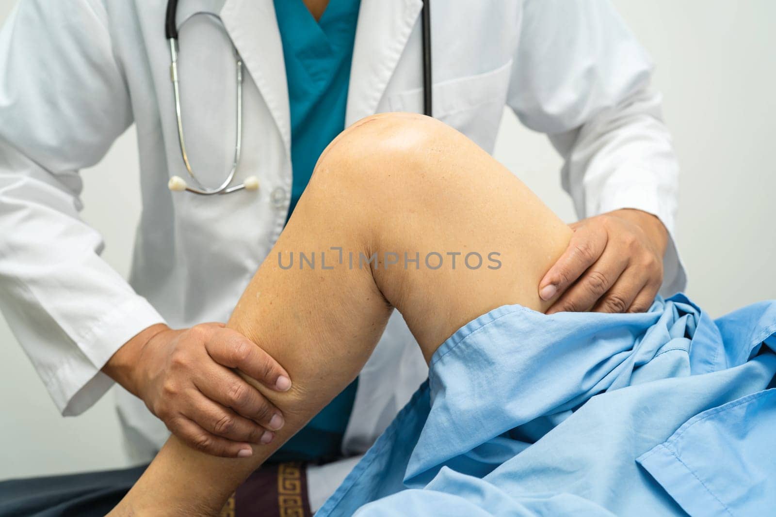 Asian elderly woman patient show her scars surgical total knee joint replacement Suture wound surgery arthroplasty on bed in nursing hospital ward, healthy strong medical concept. by pamai