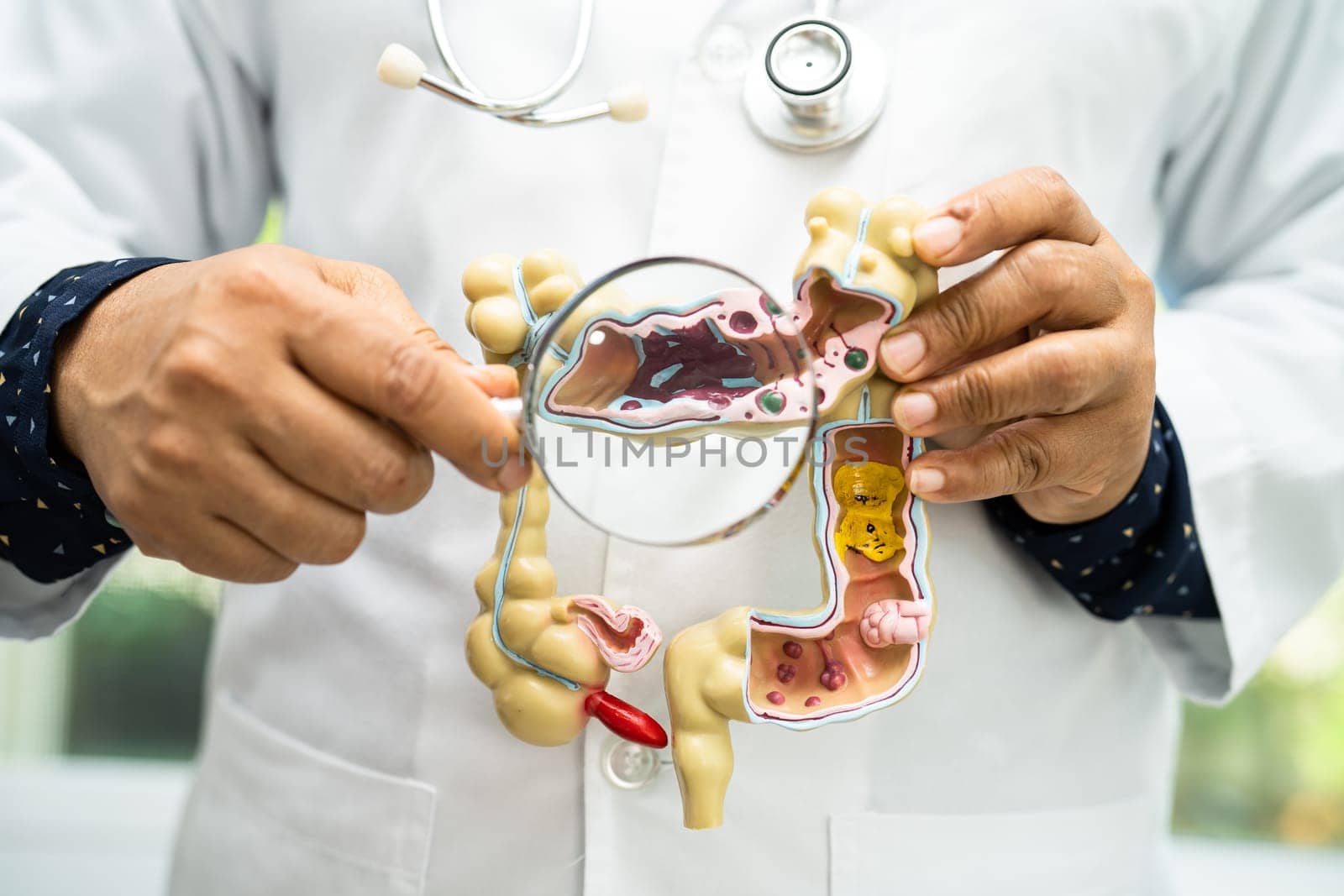 Intestine, appendix and digestive system, doctor holding anatomy model for study diagnosis and treatment in hospital.