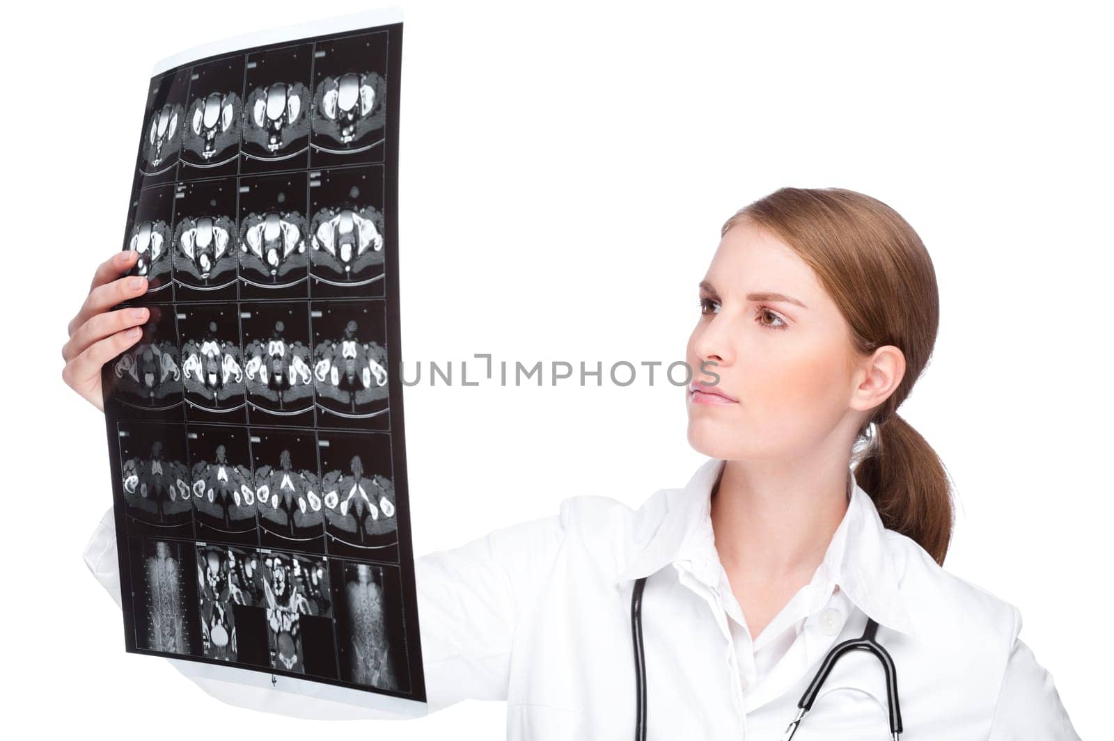 Female doctor with x-ray image