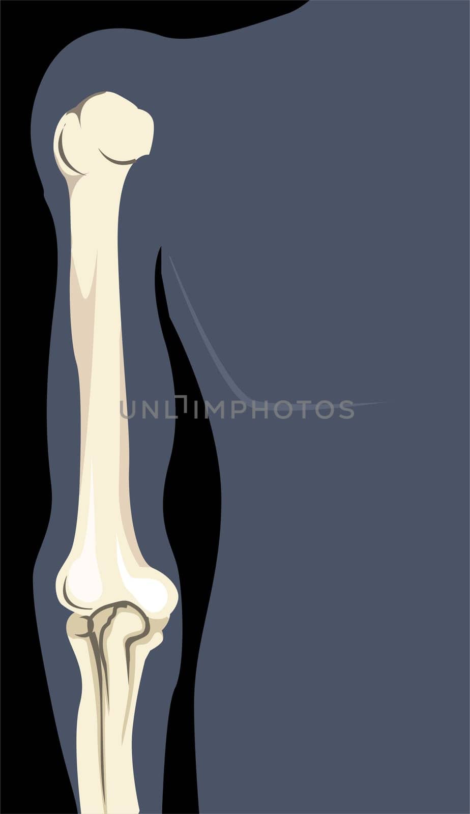 bone