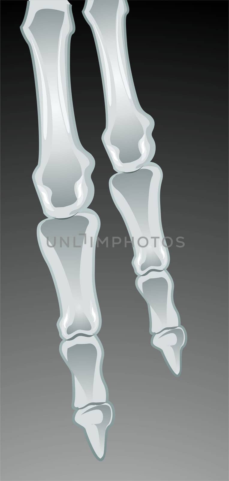 bone