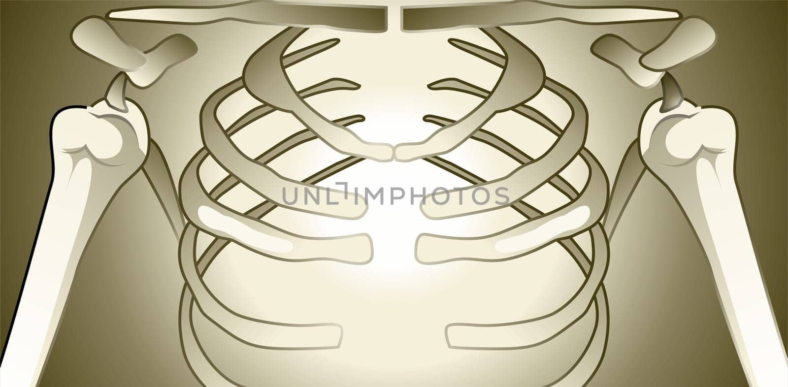 Bones