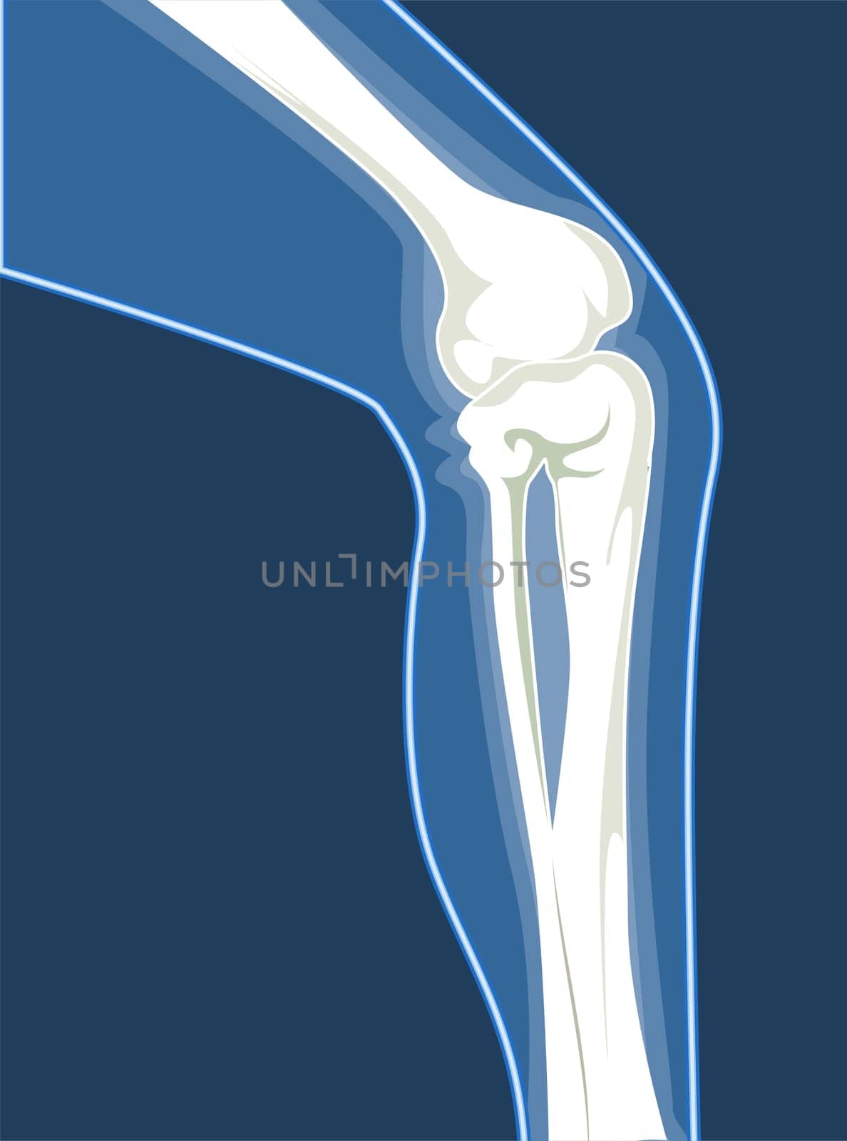 legBones