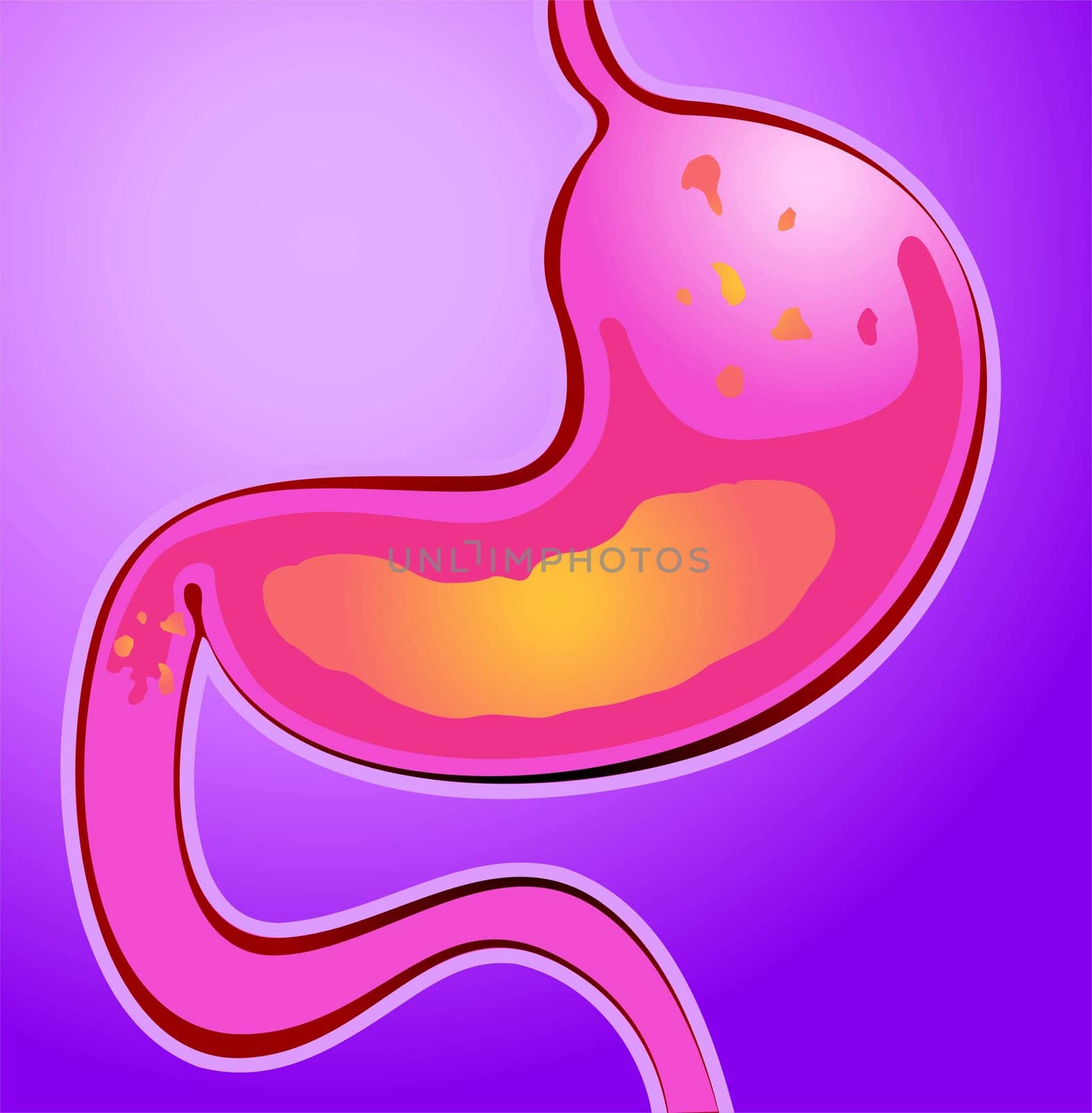 stomach