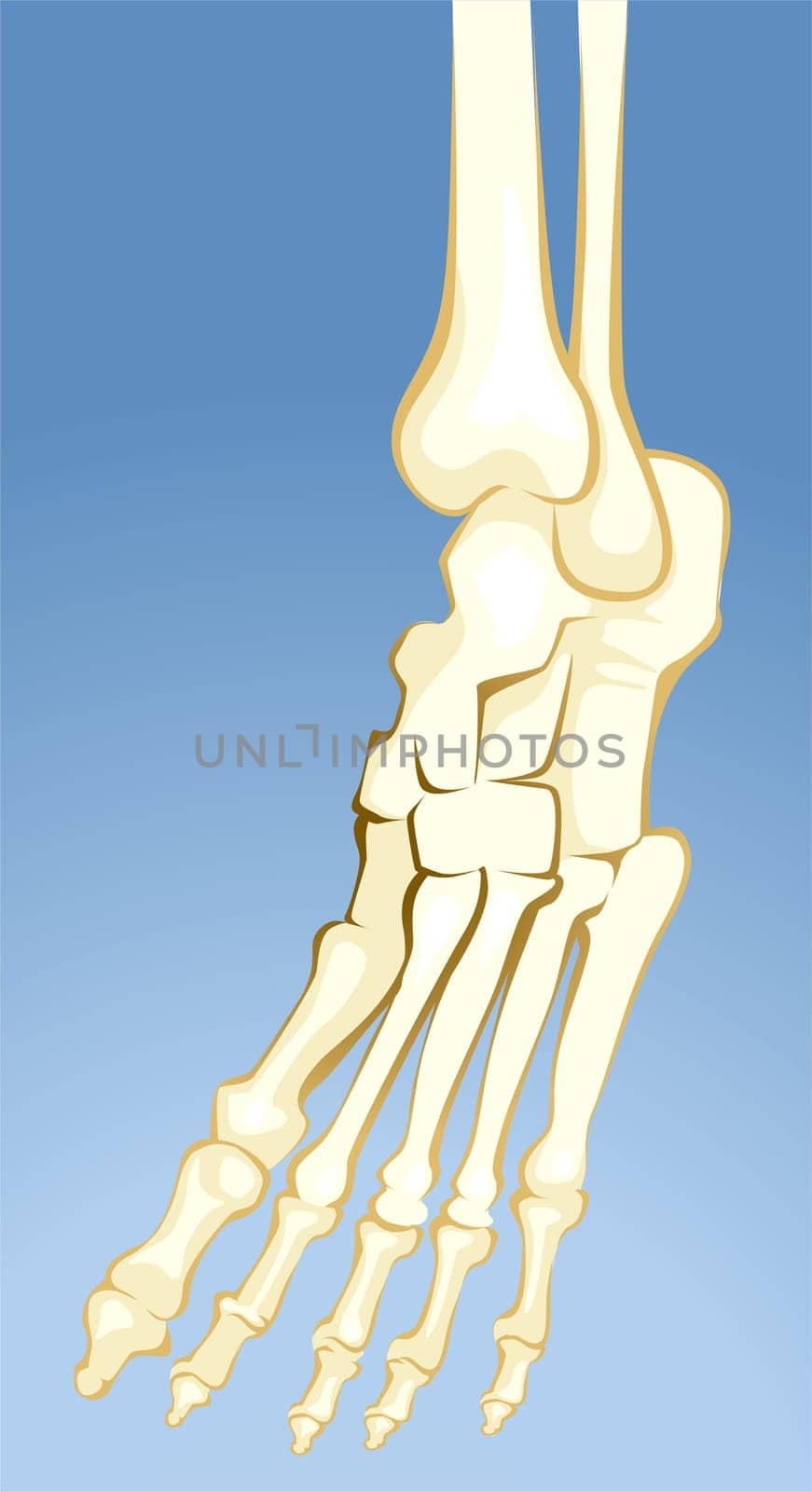 Bones